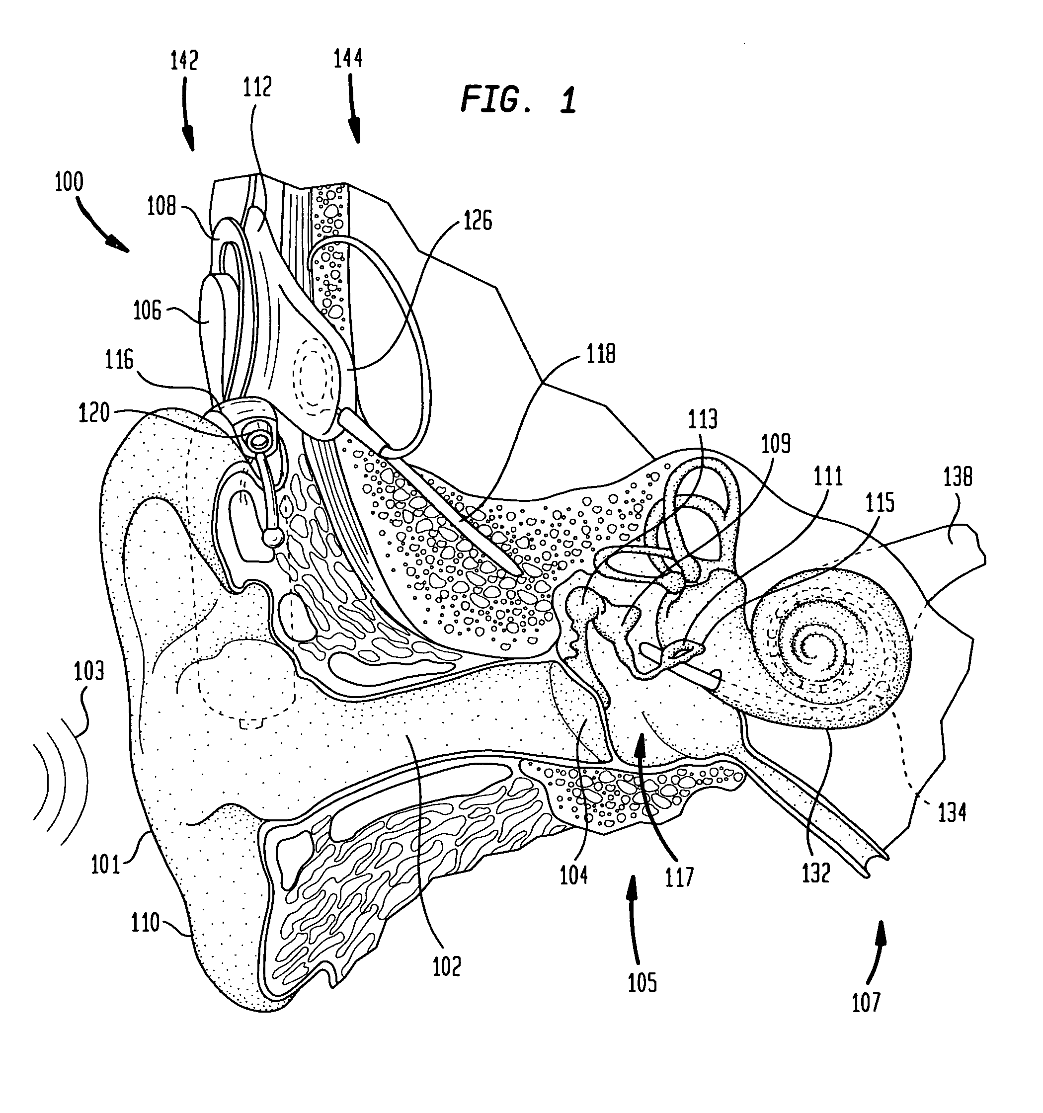 Independent and concurrent processing multiple audio input signals in a prosthetic hearing implant