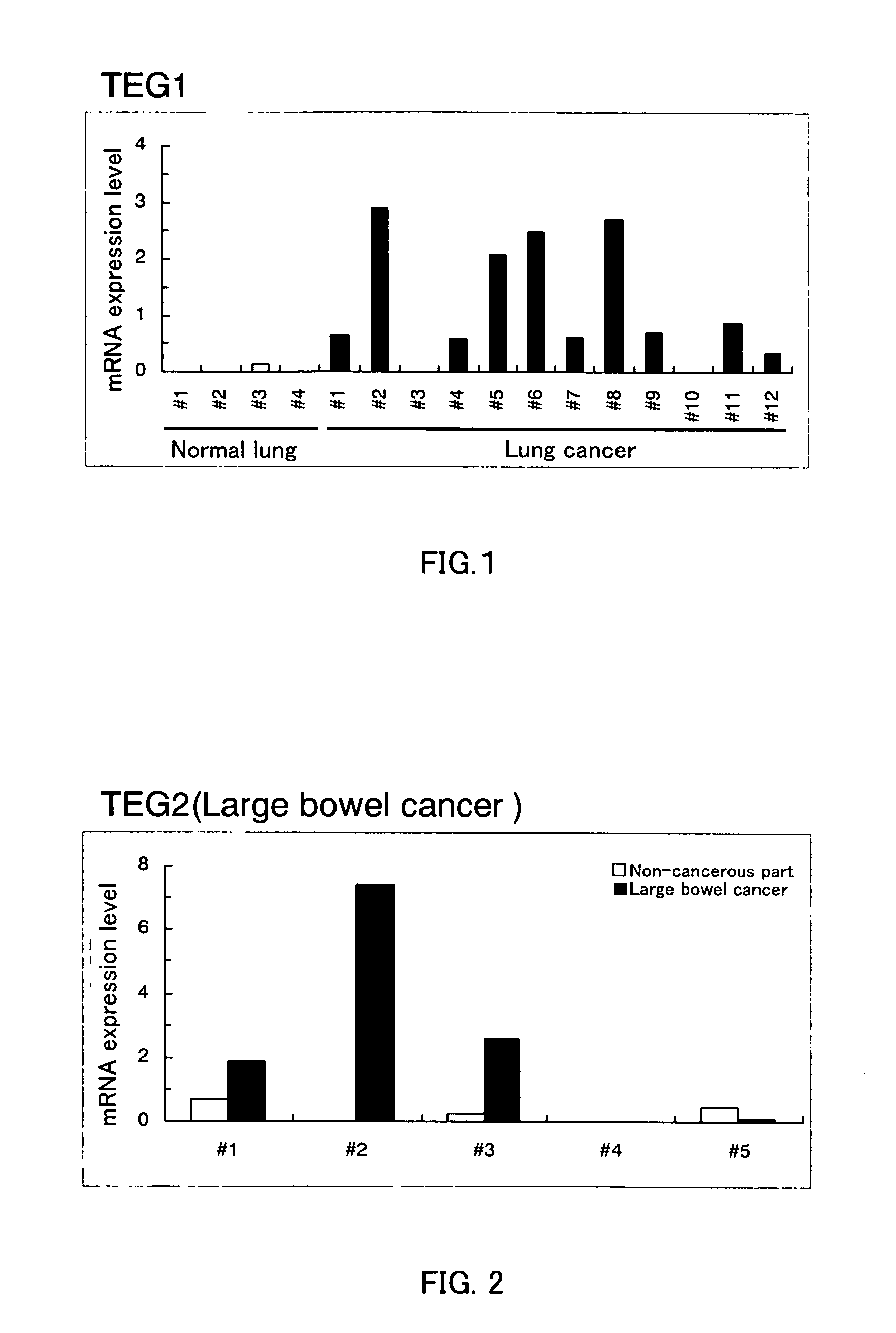 Gene Overexpressed in Cancer