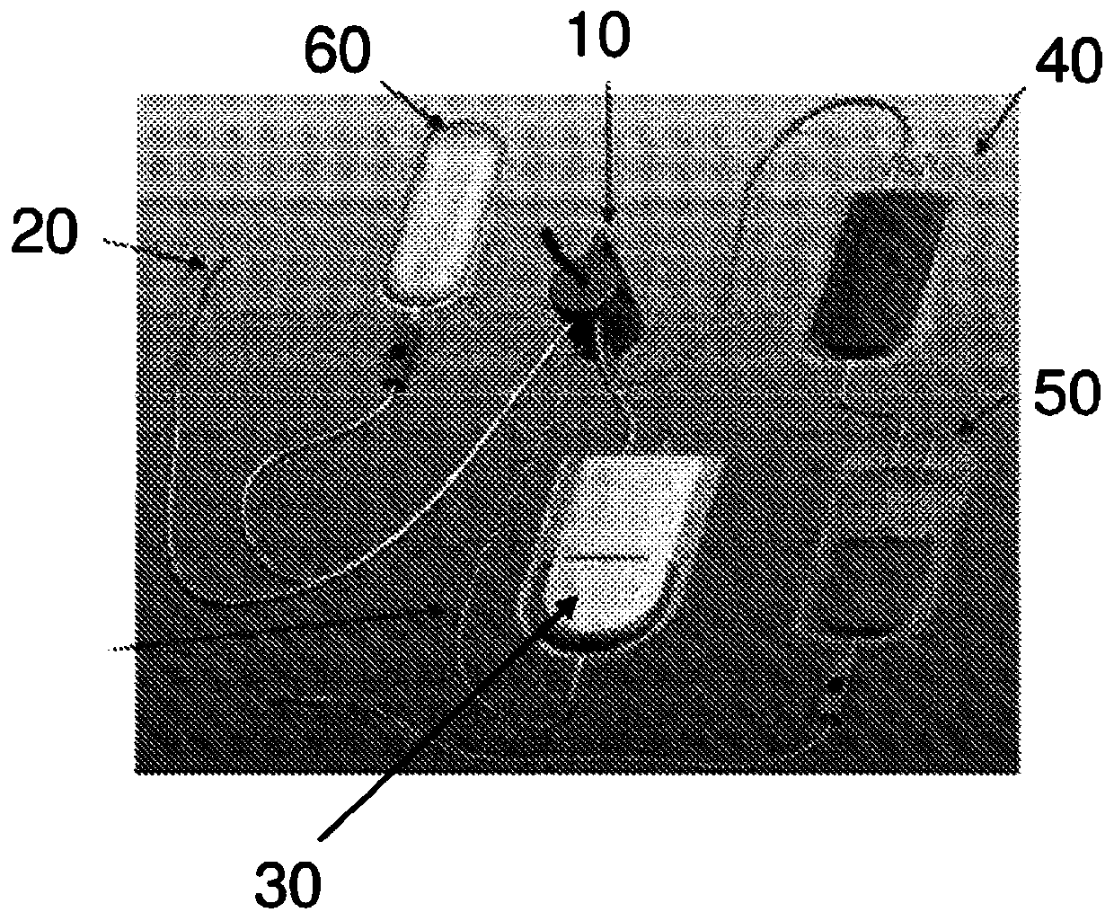 Improvements in or relating to blood salvage and autotransfusion