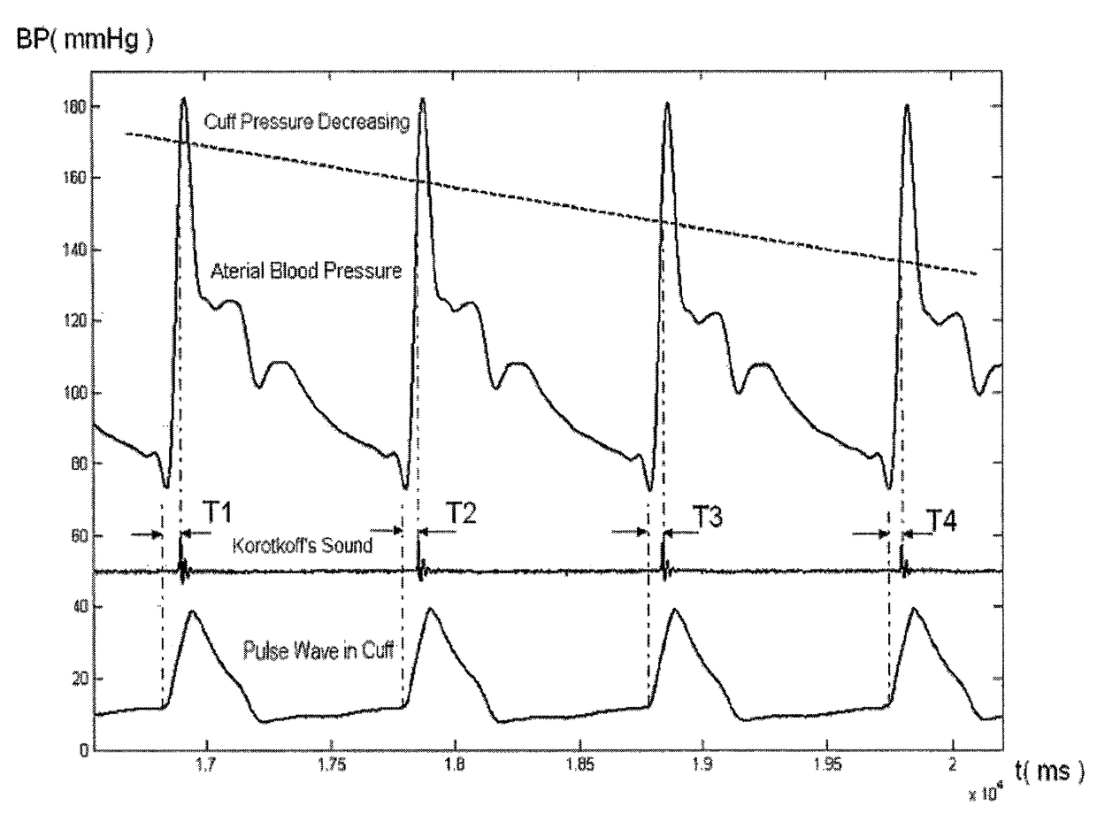 Method and apparatus for arterial blood pressure measurement and individualized rectifying technology