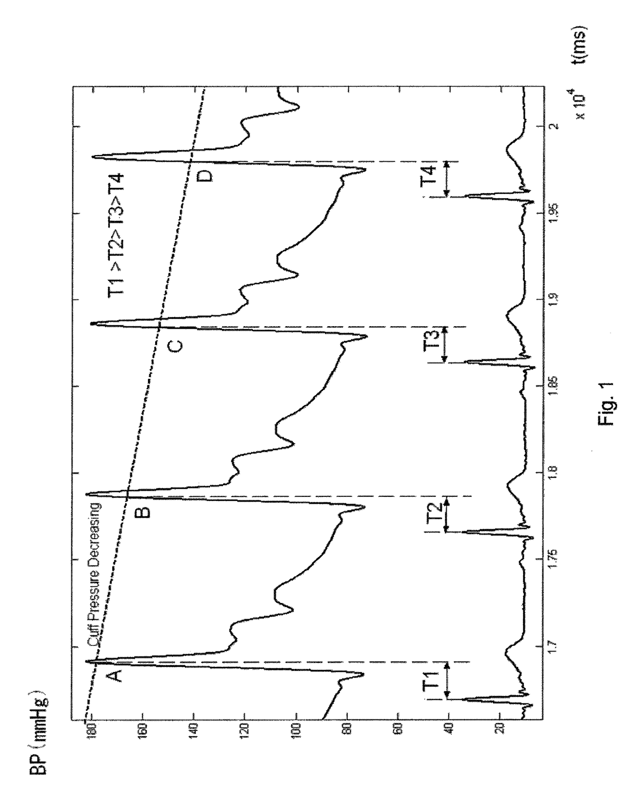 Method and apparatus for arterial blood pressure measurement and individualized rectifying technology