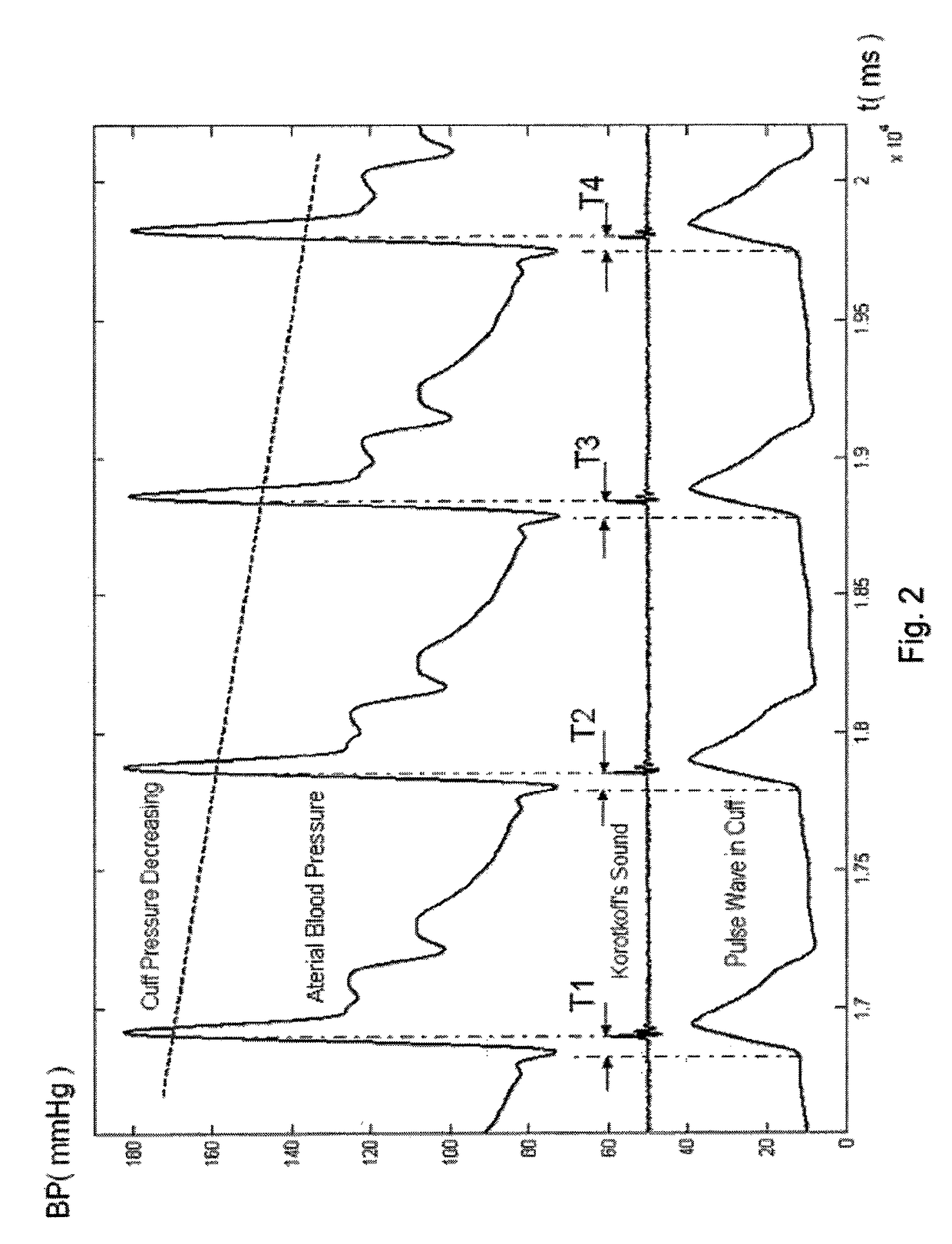 Method and apparatus for arterial blood pressure measurement and individualized rectifying technology