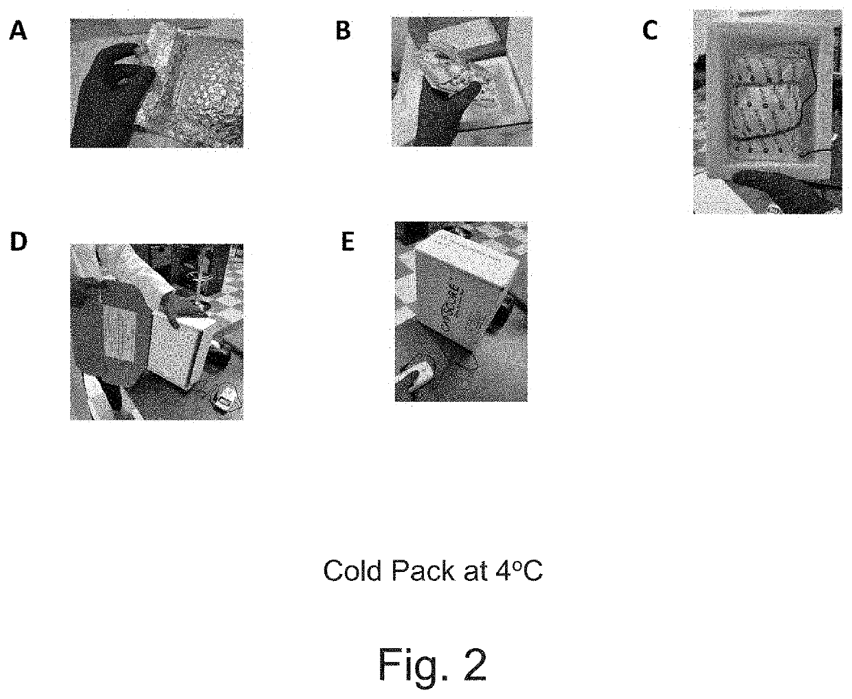 Identifying status of male fertility by determining sperm capacitation and companion collection kit