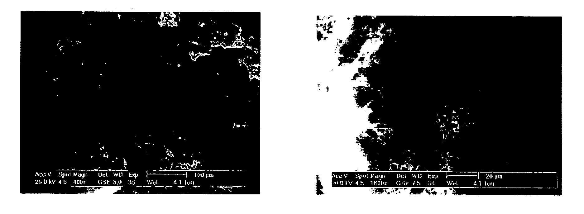 Composition for Injectable Cement Useful as Bone Replacement