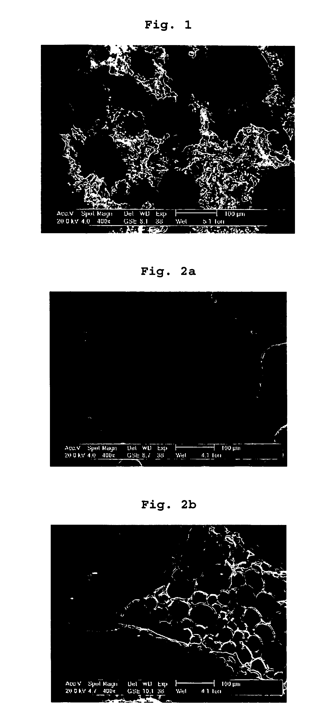 Composition for Injectable Cement Useful as Bone Replacement