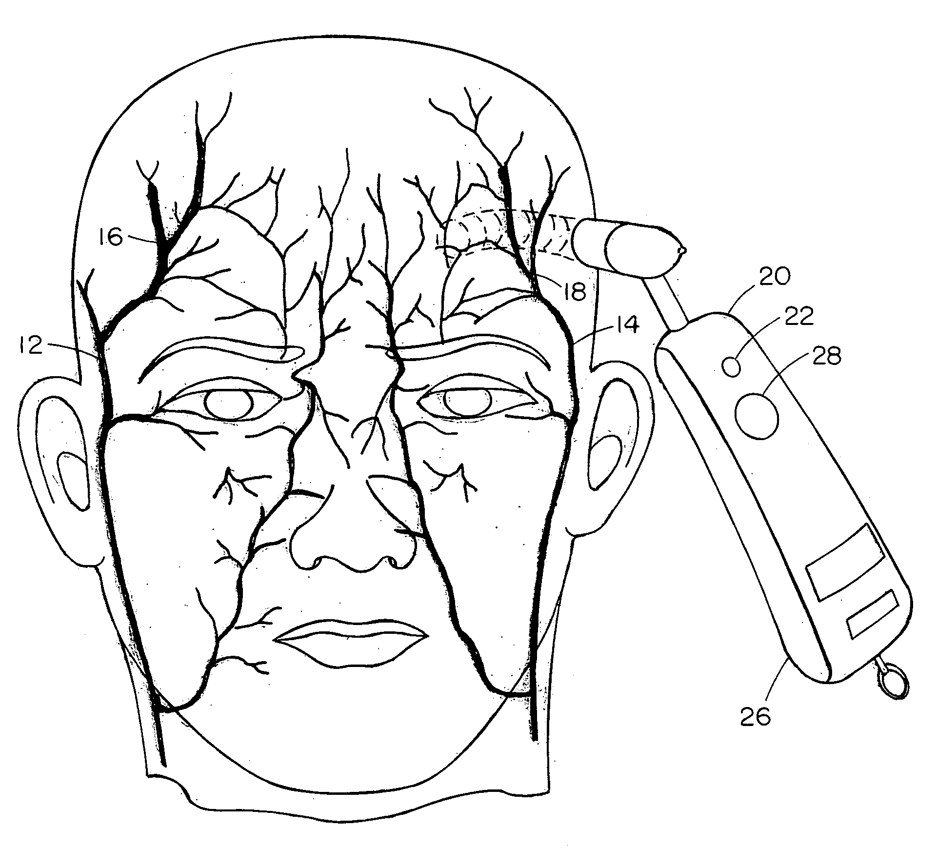 Temporal artery temperature detector