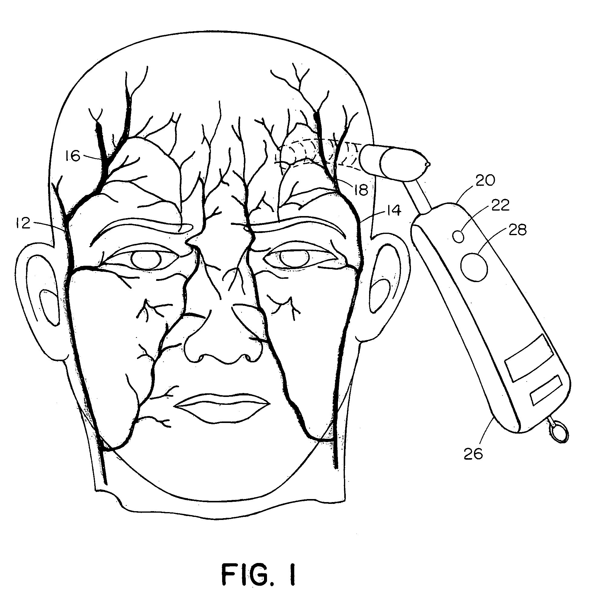 Temporal artery temperature detector