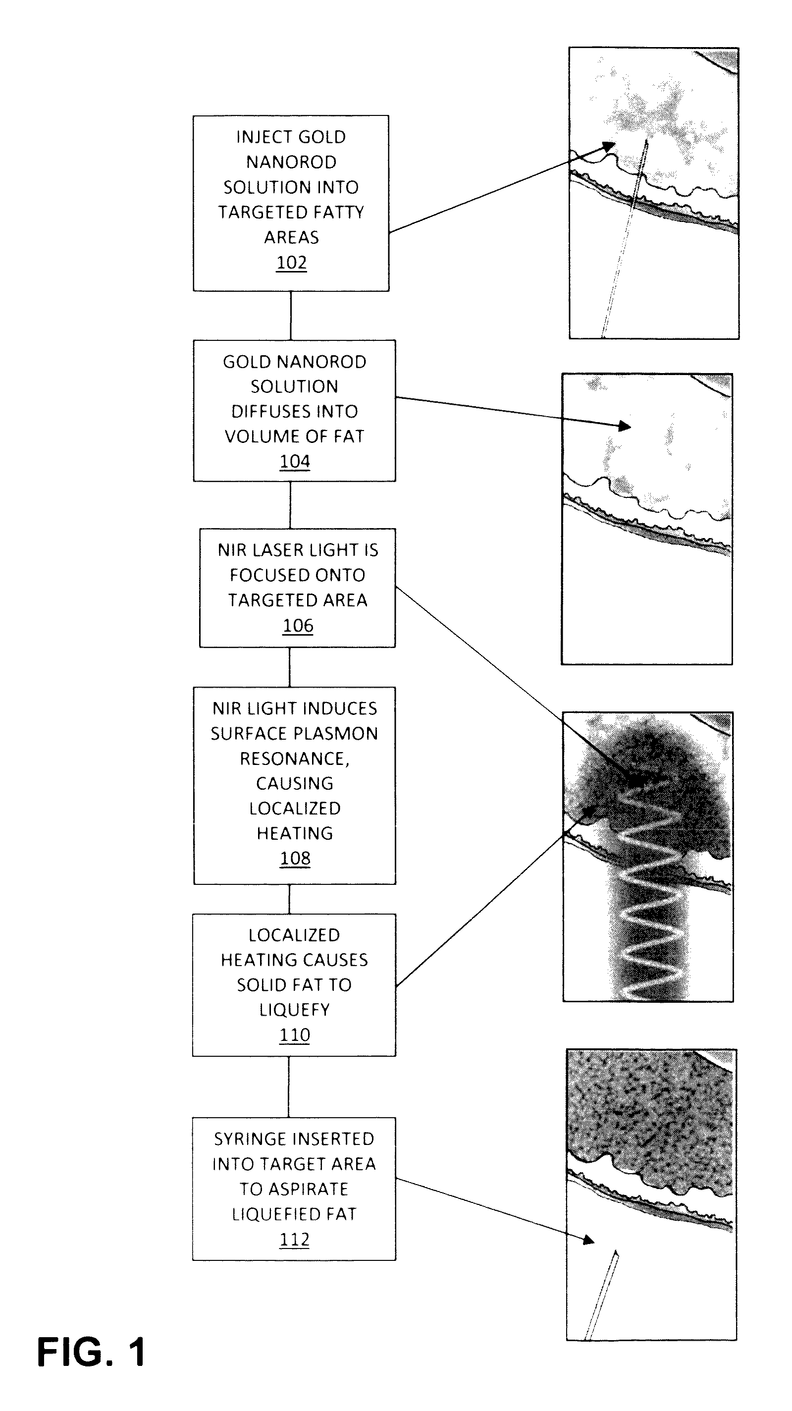 Selective fat removal using photothermal heating