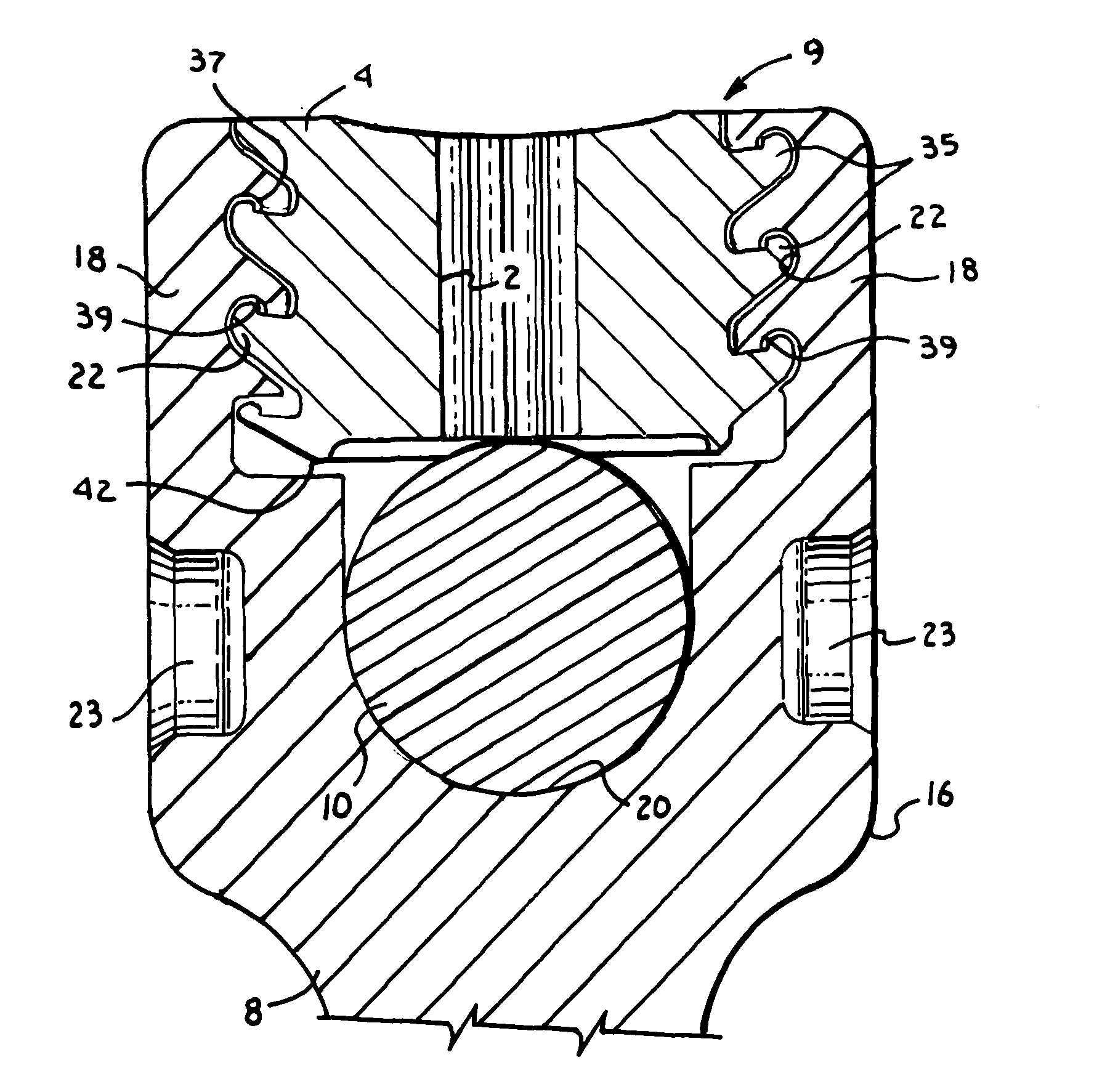 Anti-splay medical implant closure with multi-surface removal aperture