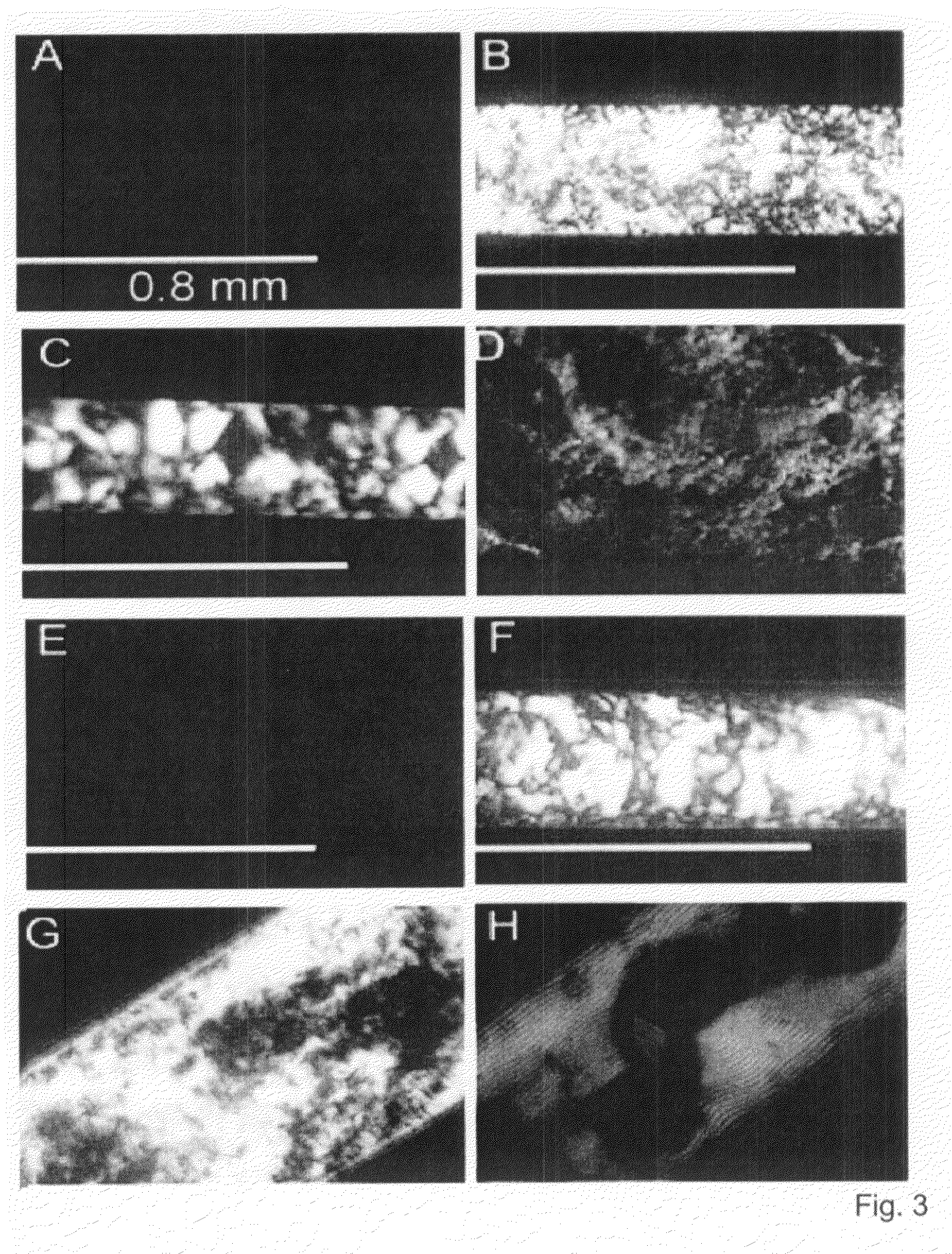 Β-peptide lyotropic liquid crystals and methods of manufacture and use thereof