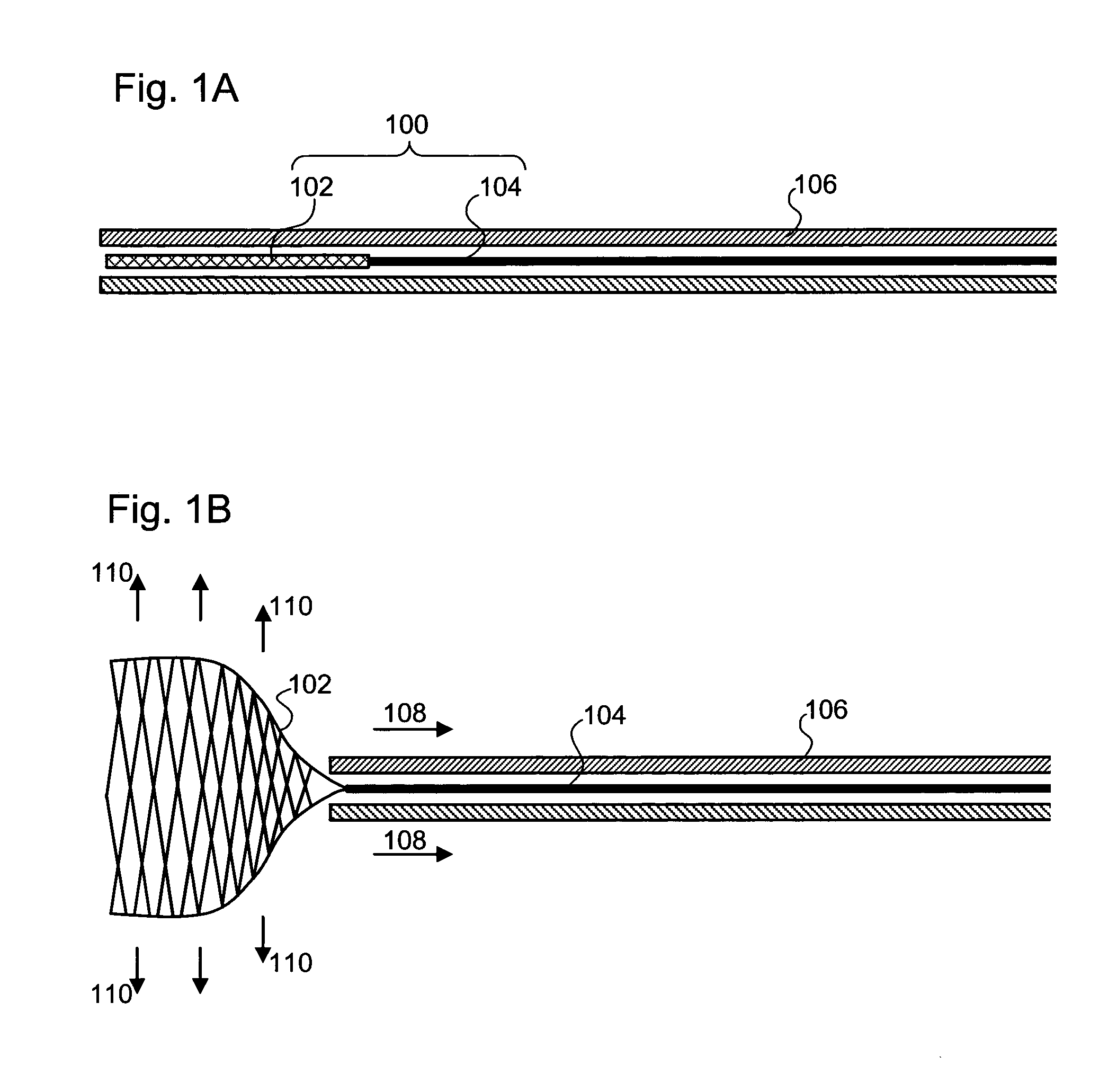 Guidewire with anchor