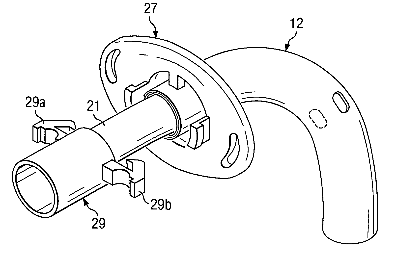 Tracheostomy system