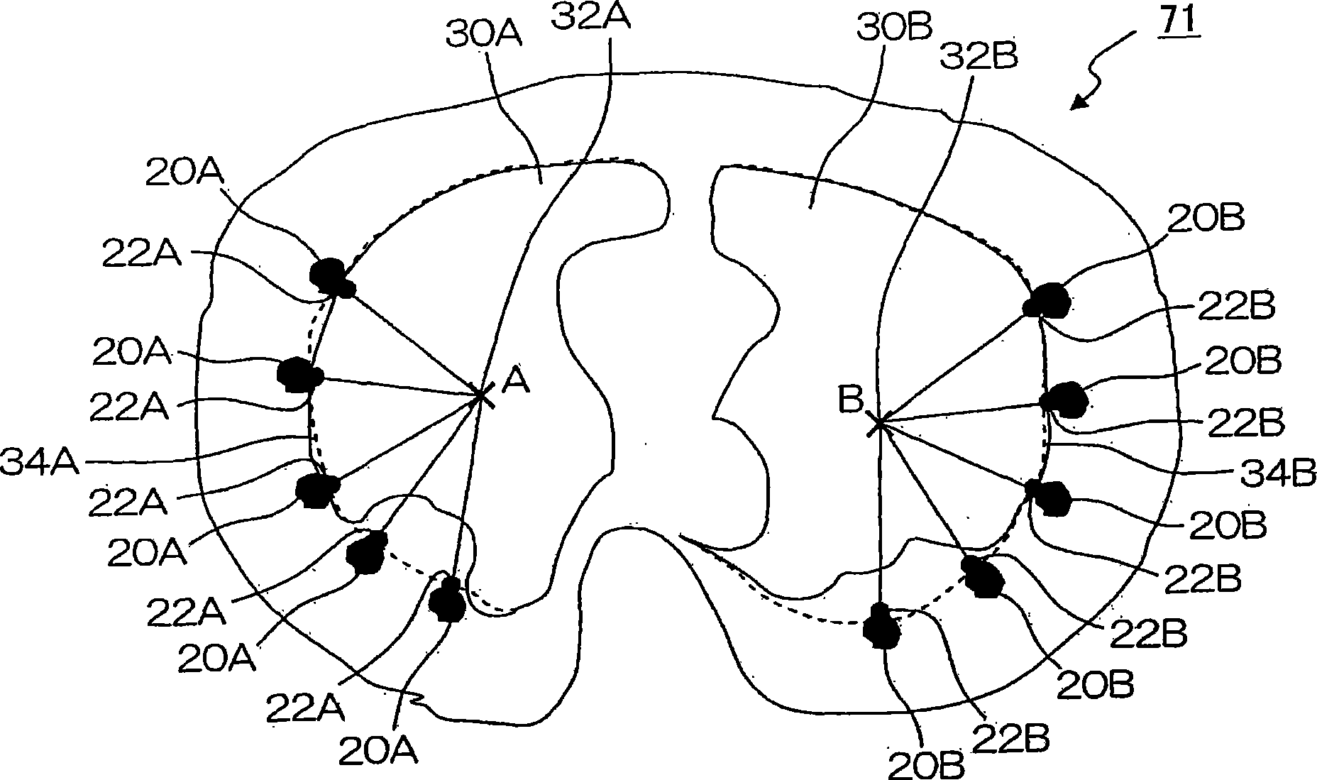 Image diagnosis support device and image diagnosis support program