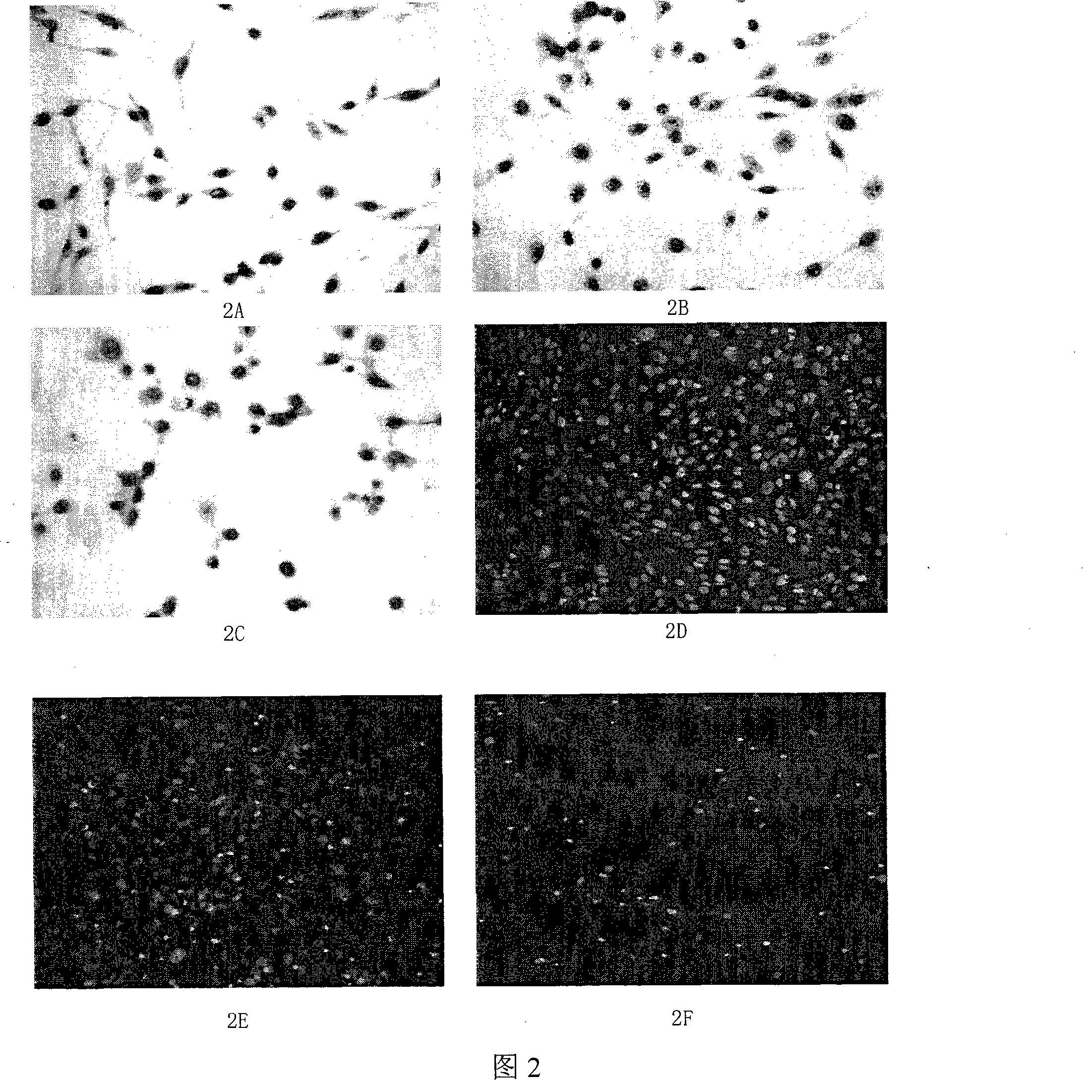 Nano granule preparations of catharanthus roseus alkaloids anti-tumor medicaments and preparation thereof