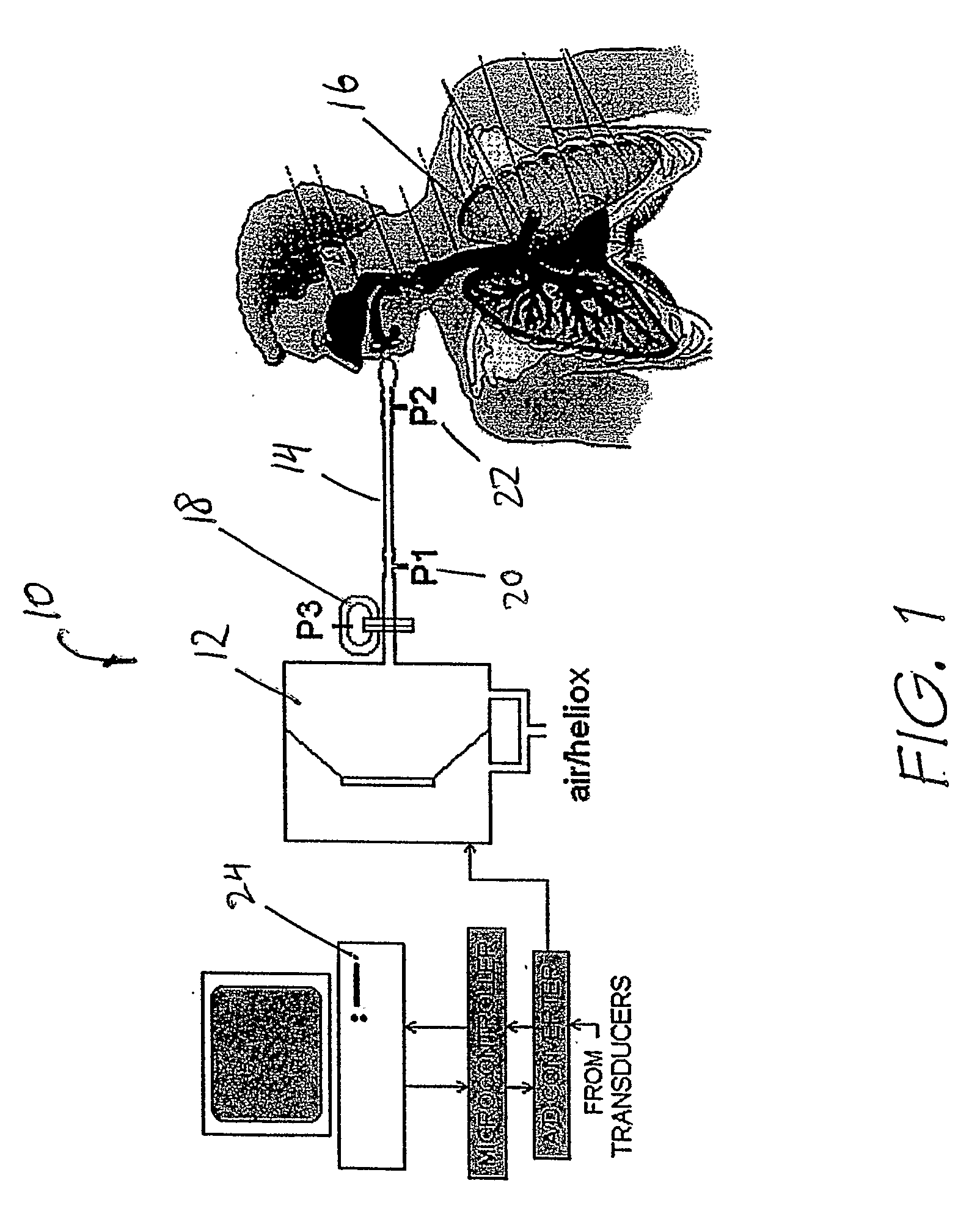 Method of measuring an acoustic impedance of a respiratory system and diagnosing a respiratory disease or disorder or monitoring treatment of same