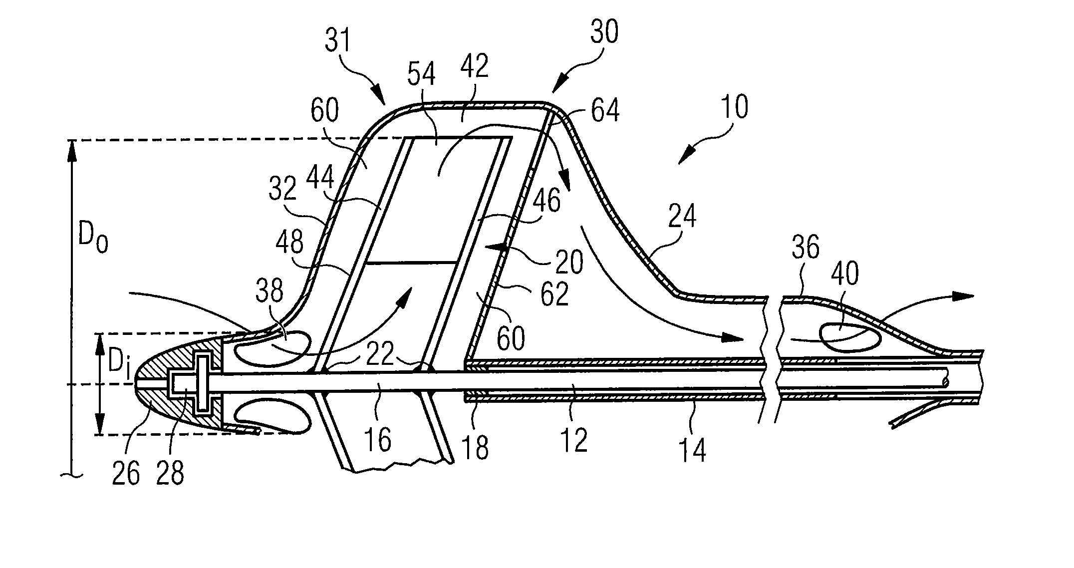 Intravascular blood pump