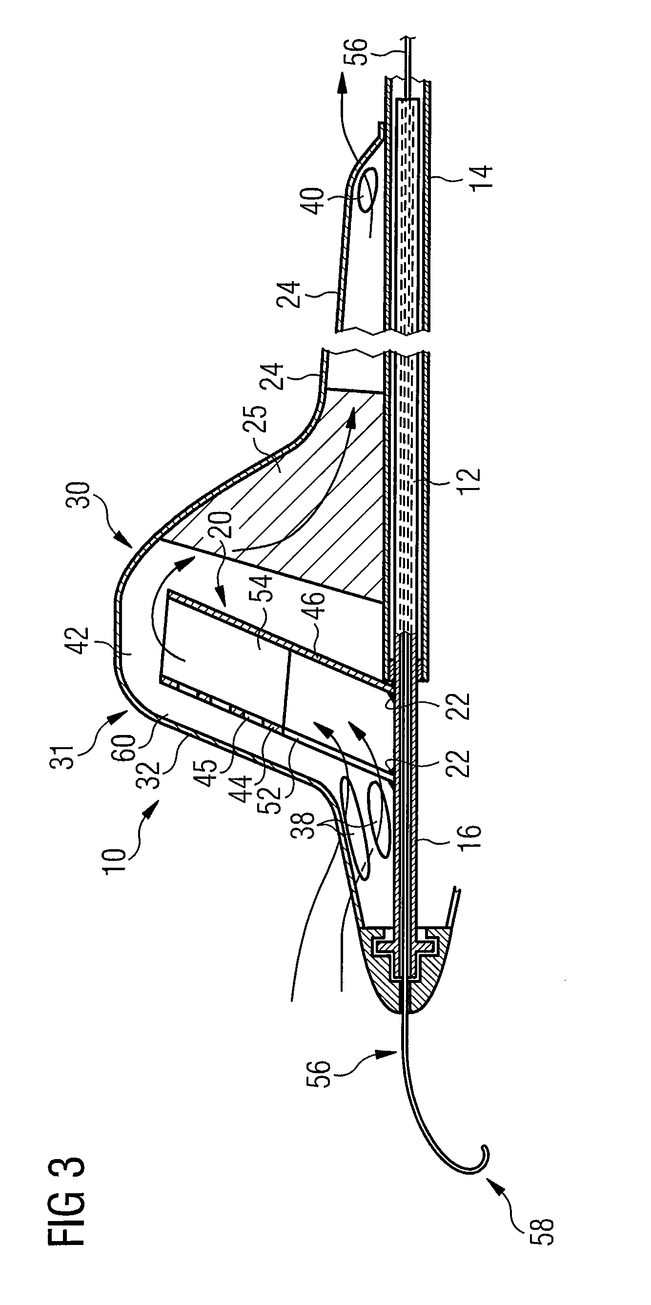 Intravascular blood pump