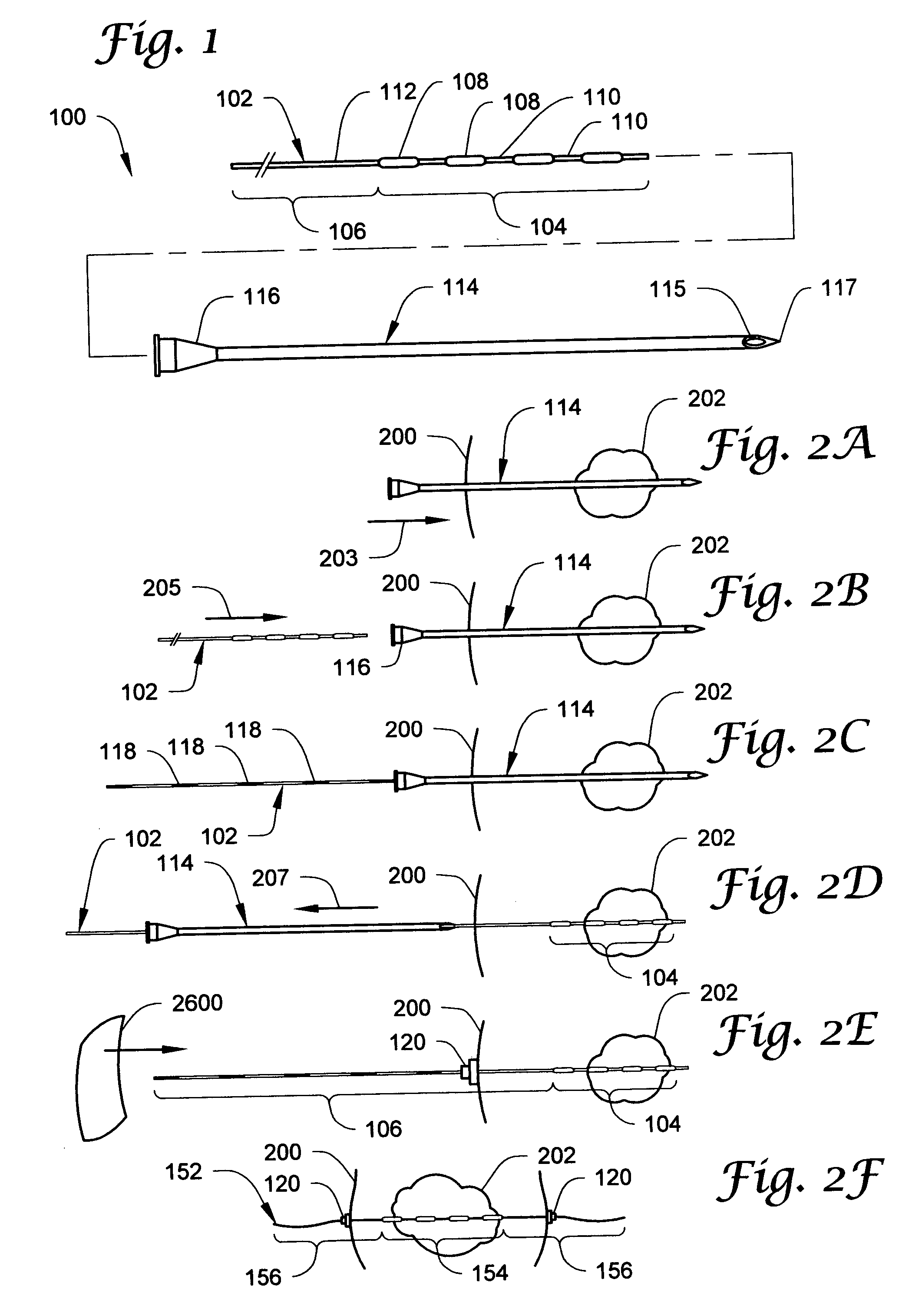 Brachytherapy apparatus and methods of using same