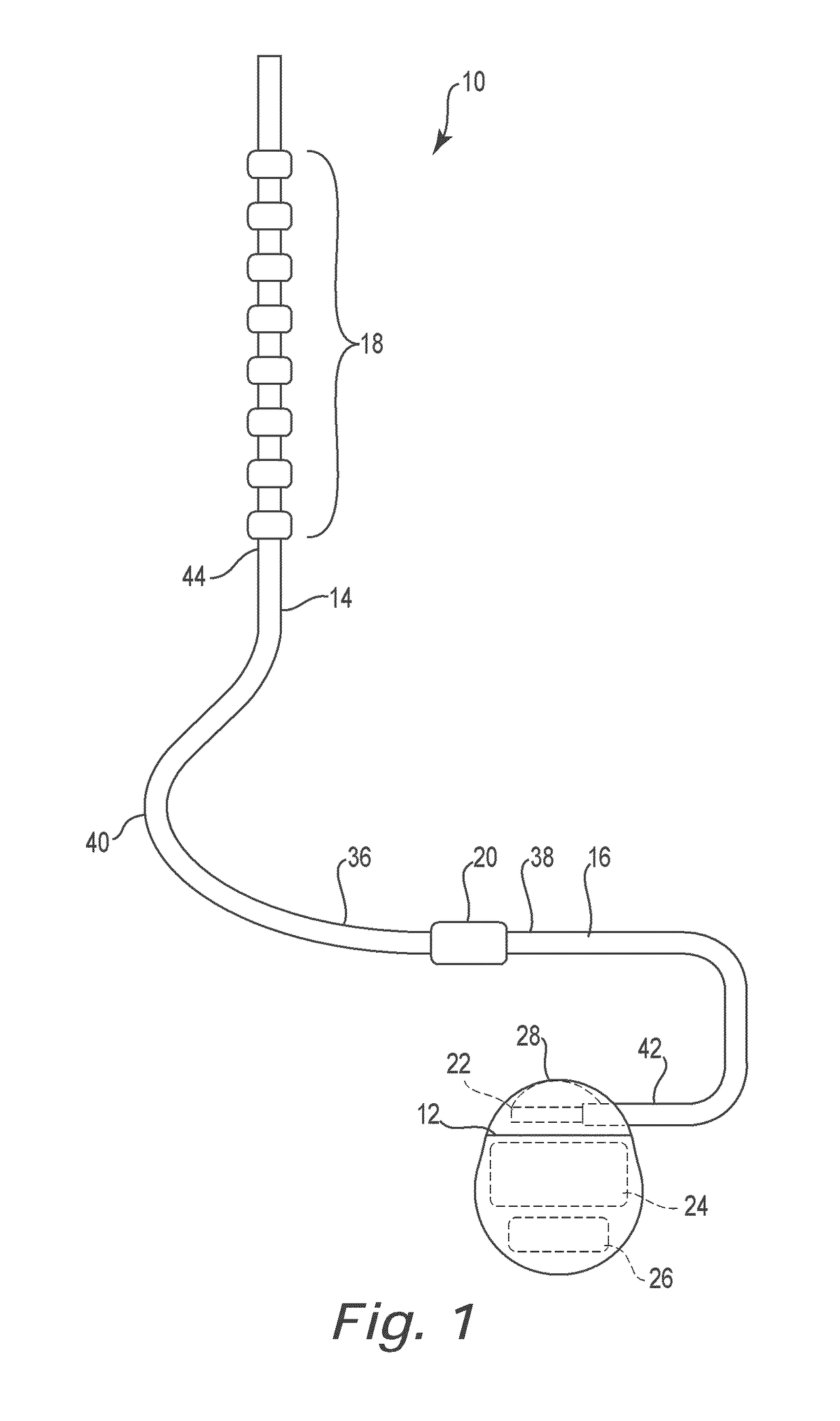 Lead identification system