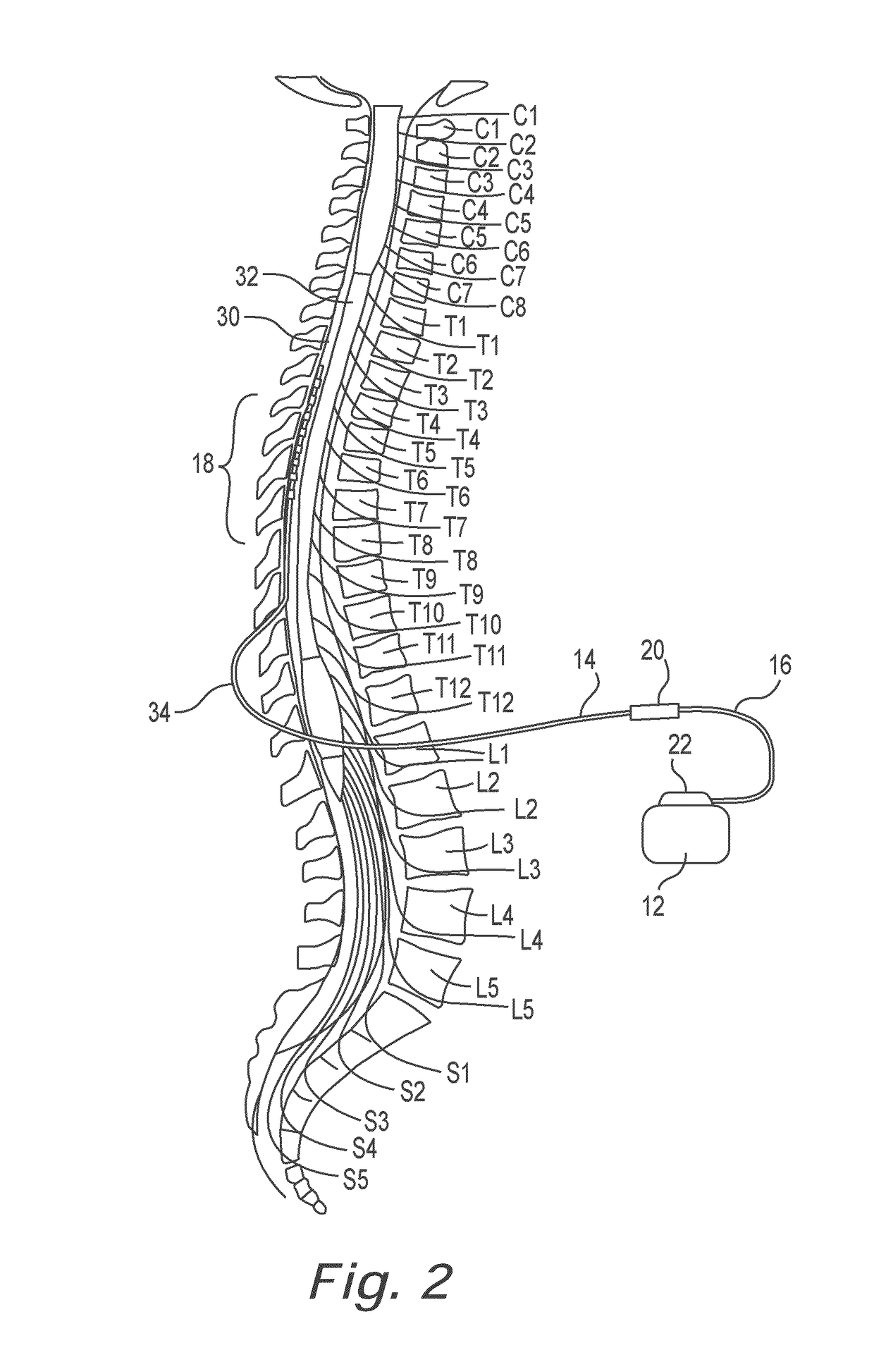 Lead identification system