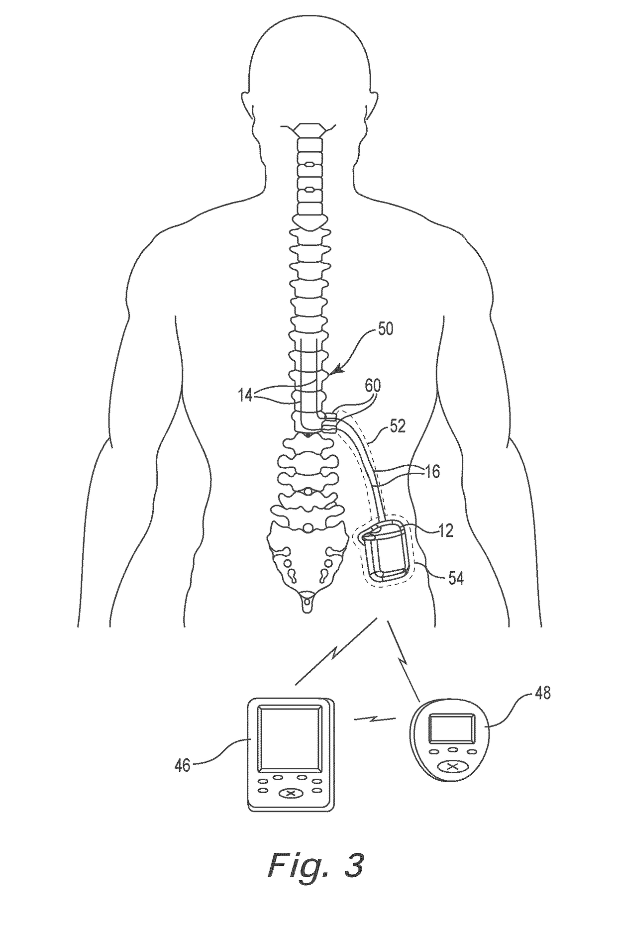 Lead identification system