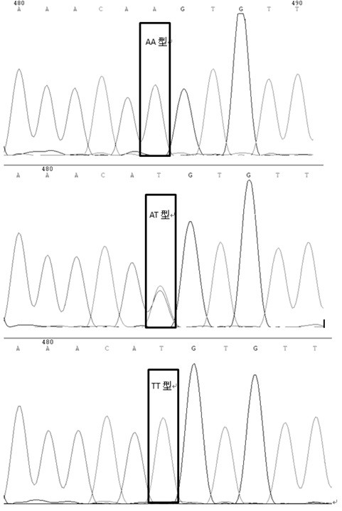 MC4R gene molecular marker related to Sujiang pig production traits as well as preparation method and application thereof