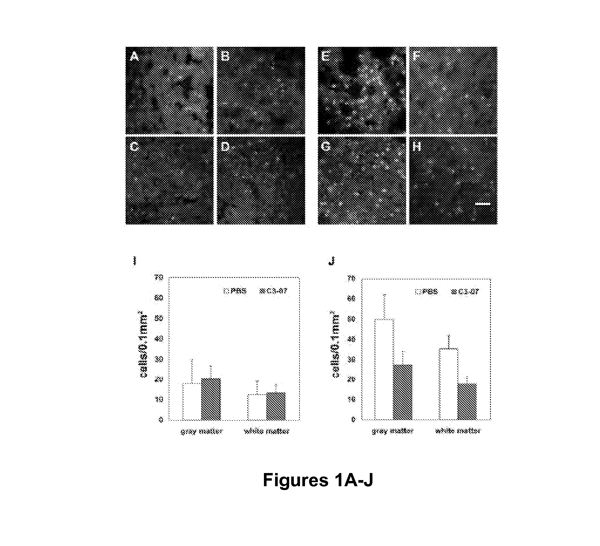 Inhibition of rho and or rock and cell transplantation