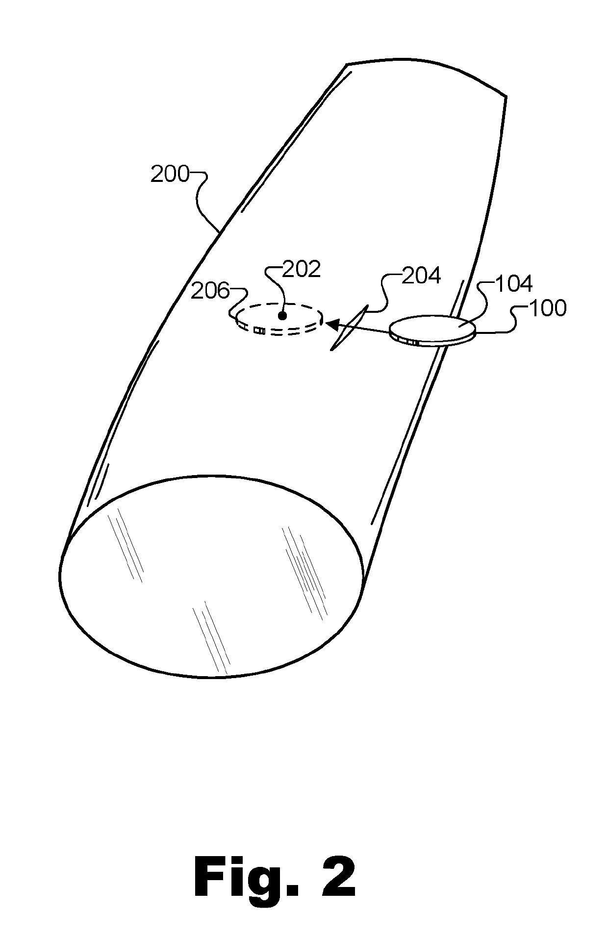 Methods and systems for treating osteoarthritis using an implantable electroacupuncture device