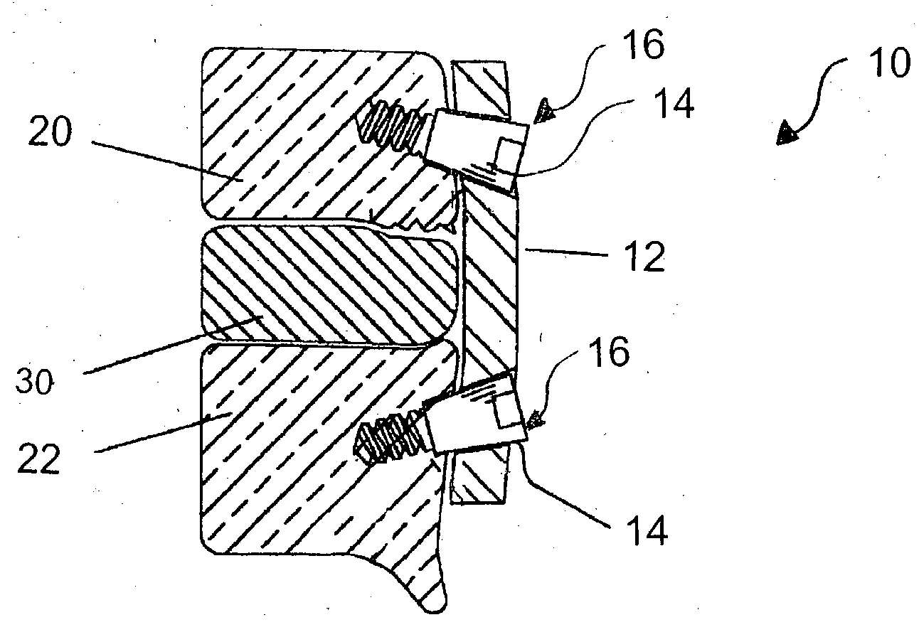 Vertebral implant for bone fixation or interbody use