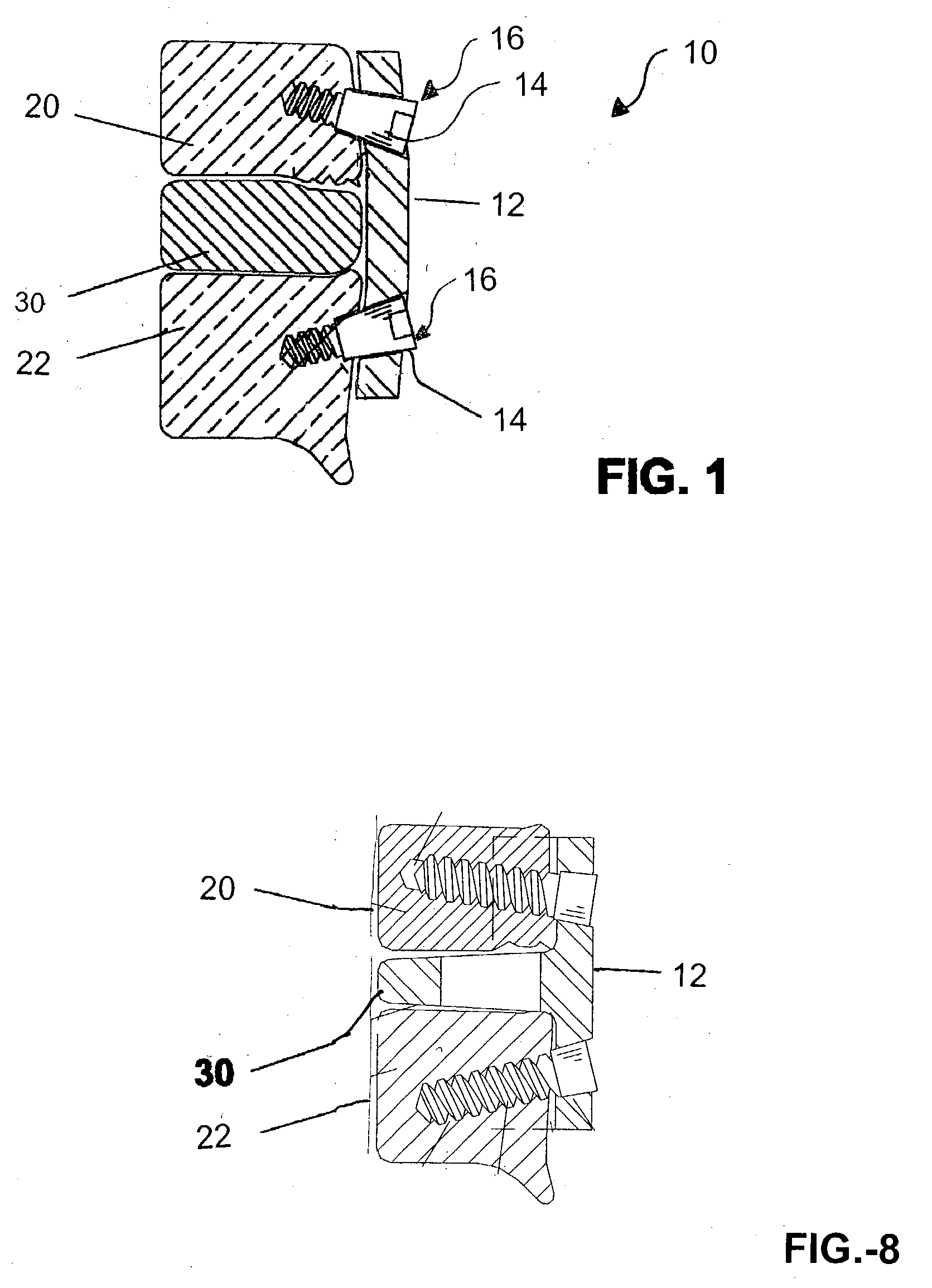 Vertebral implant for bone fixation or interbody use