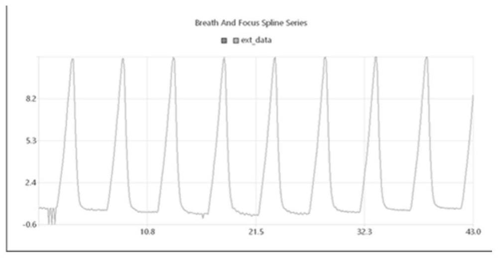 Puncture method based on phase registration