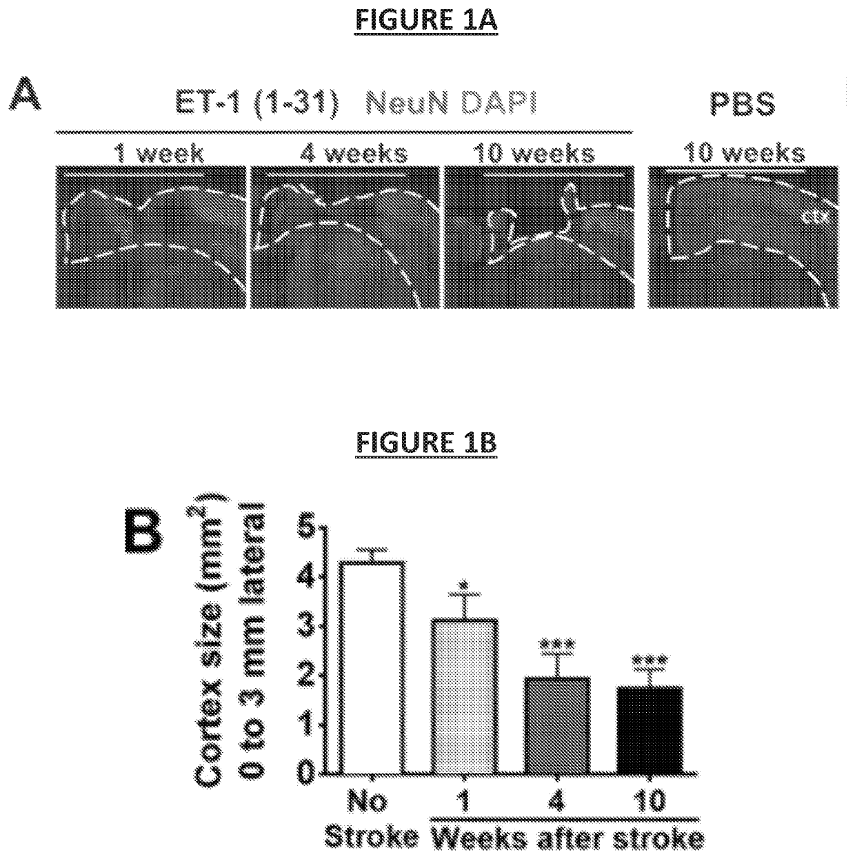 Regenerating functional neurons for treatment of neural injury caused by disruption of blood flow