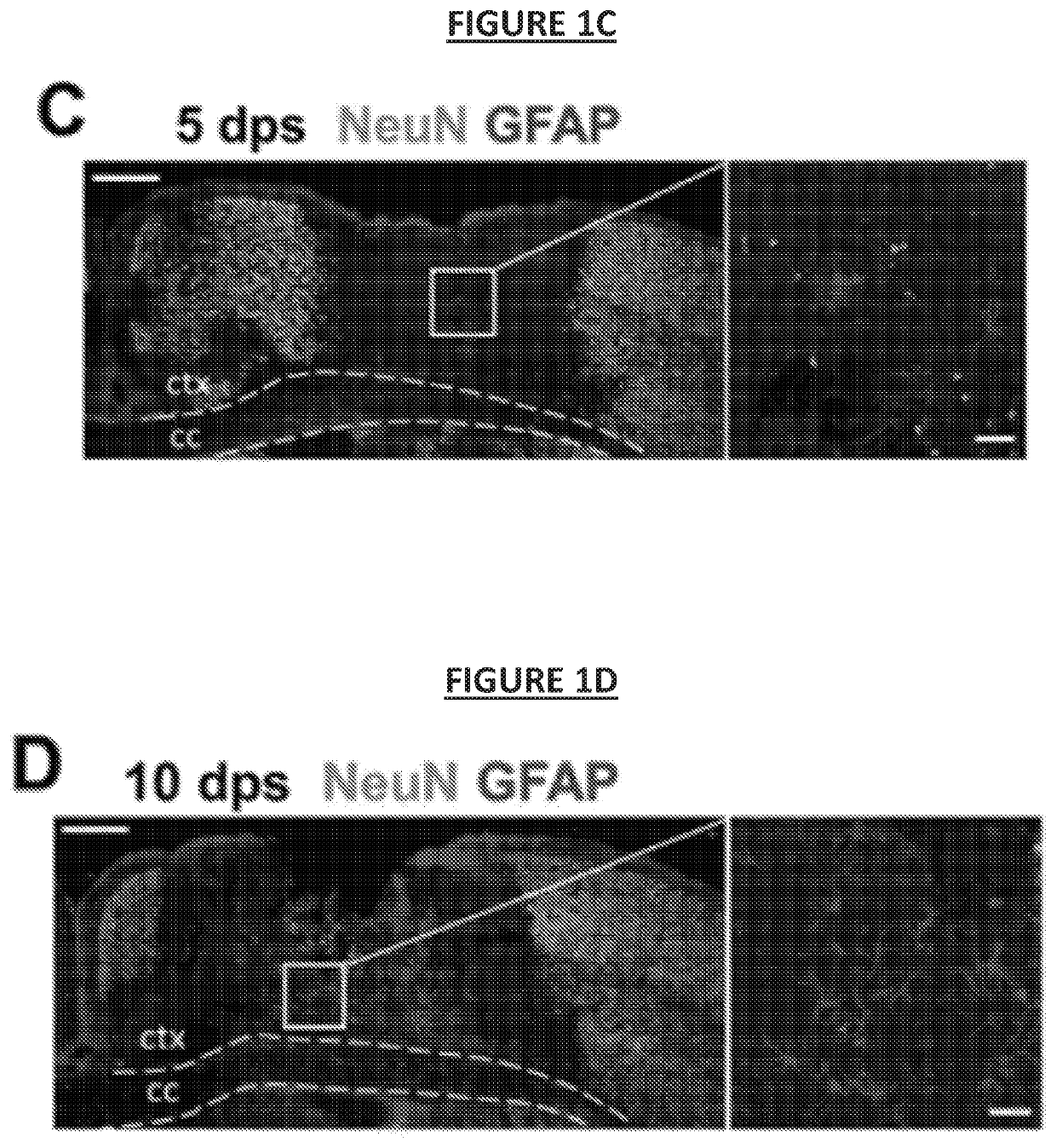 Regenerating functional neurons for treatment of neural injury caused by disruption of blood flow