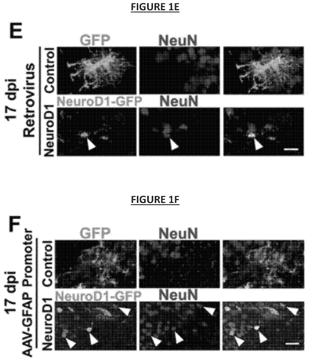 Regenerating functional neurons for treatment of neural injury caused by disruption of blood flow