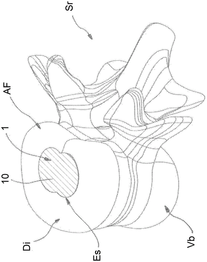 Improved Silicon Nucleus Implant