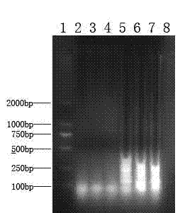 Duck viral hepatitis type 1 RT-LAMP detection kit and detection method thereof