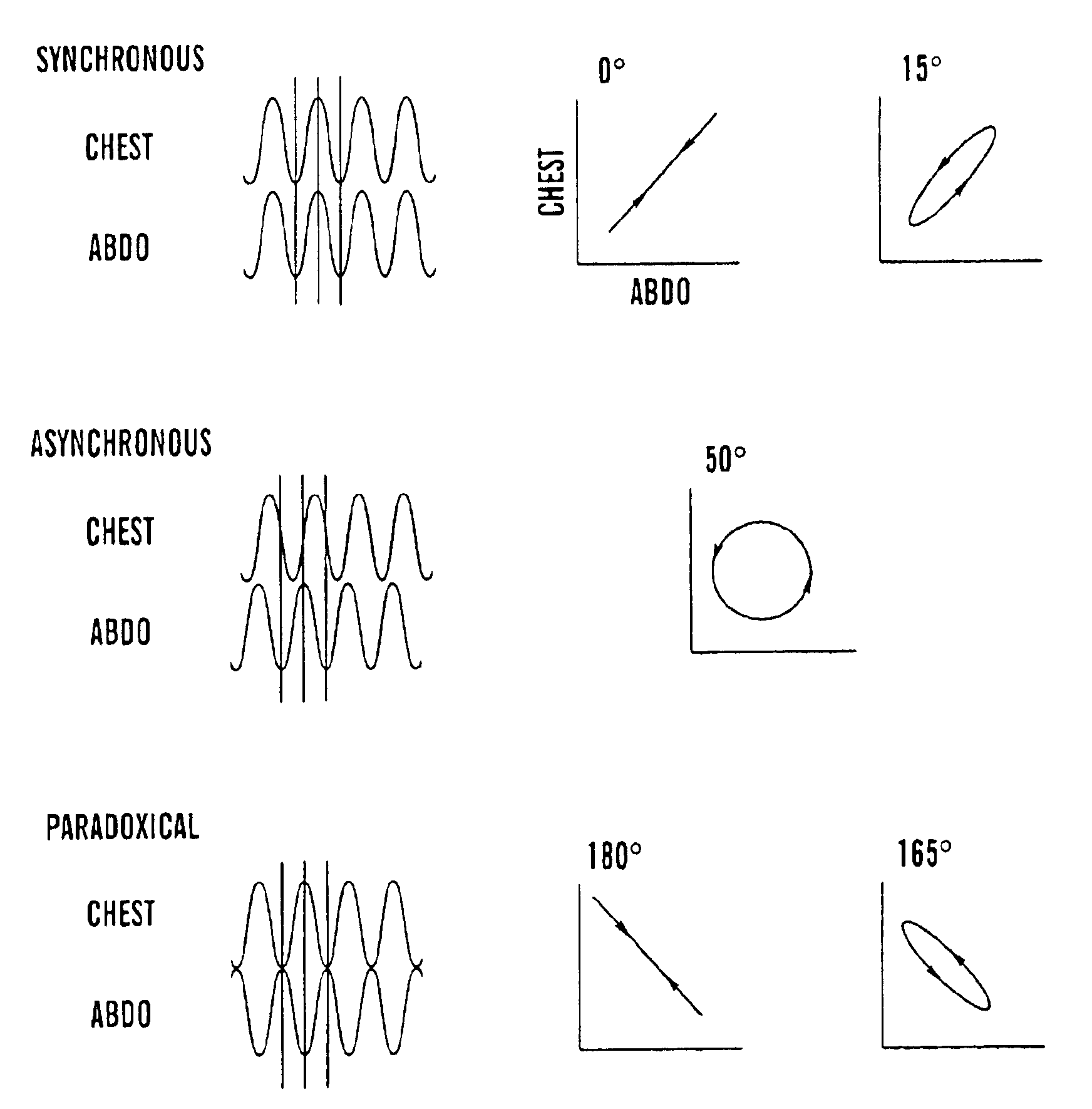 Analysis of Sleep Apnea