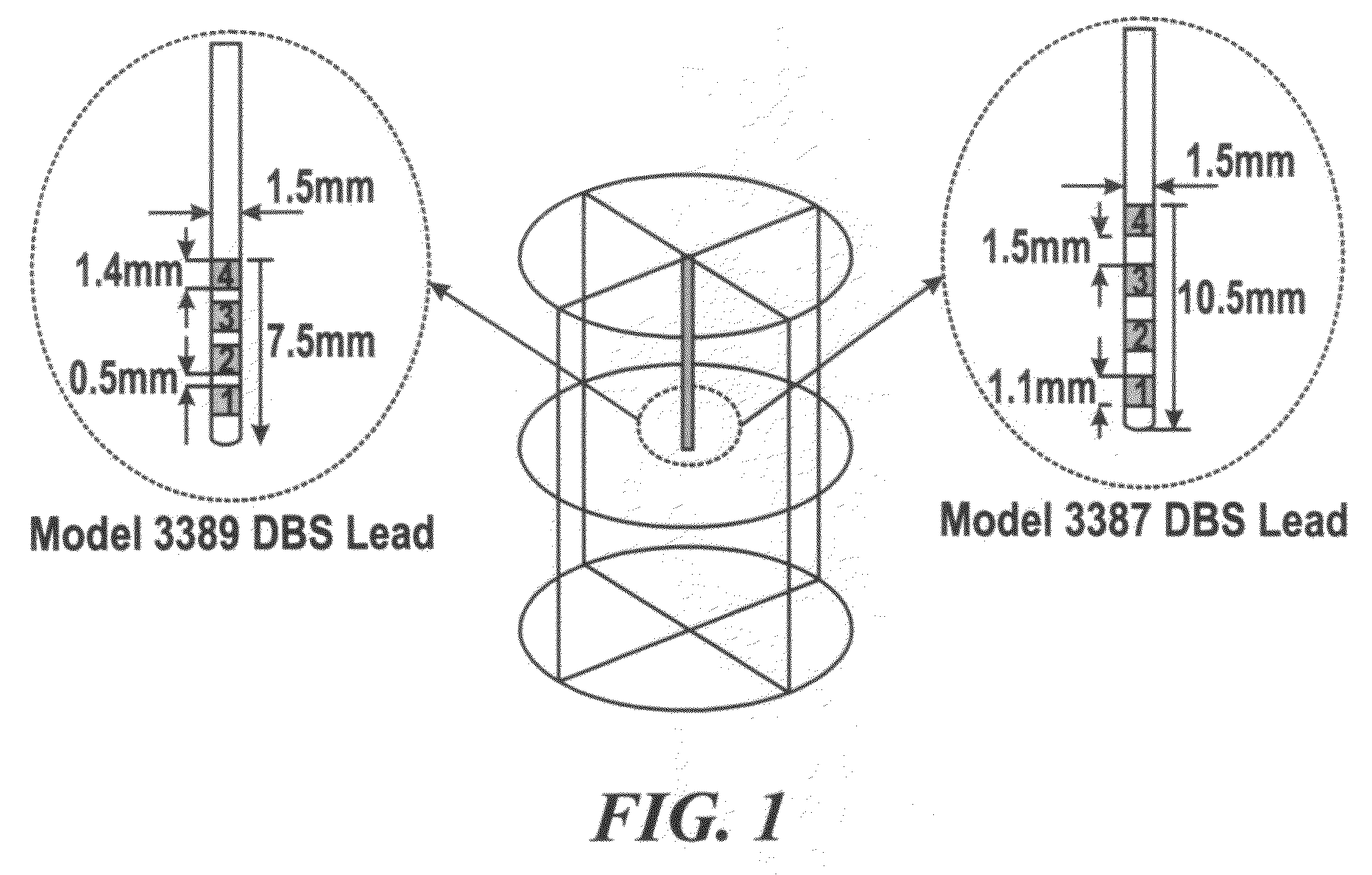 Method to reduce heating at implantable medical devices including neuroprosthetic devices