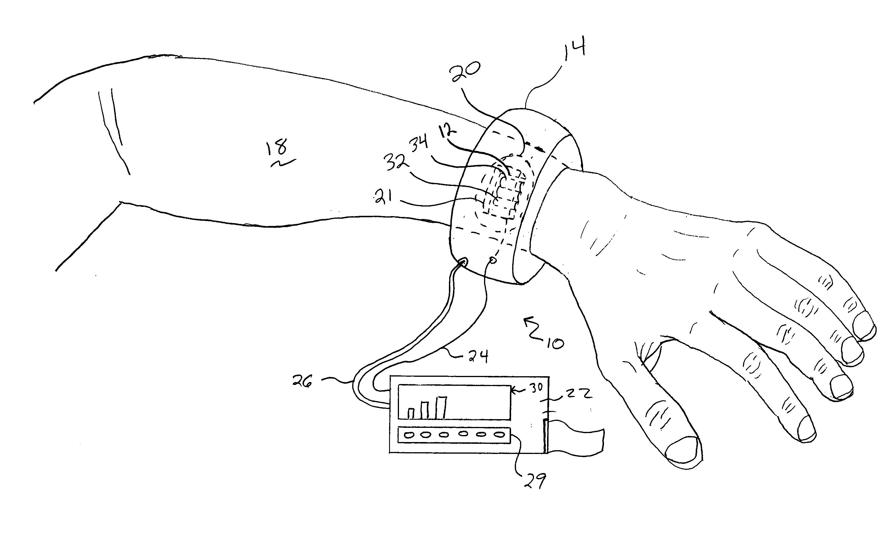 Method and instrument for automated measurement of skin perfusion pressure