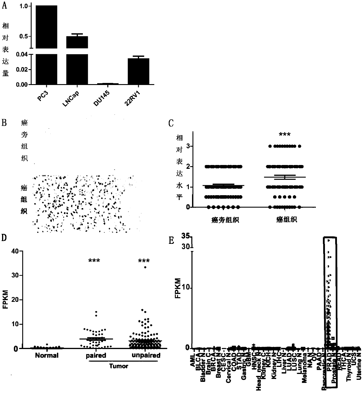 Long chain non-encoding RNA sequence for early diagnosis of human prostatic cancer and its application