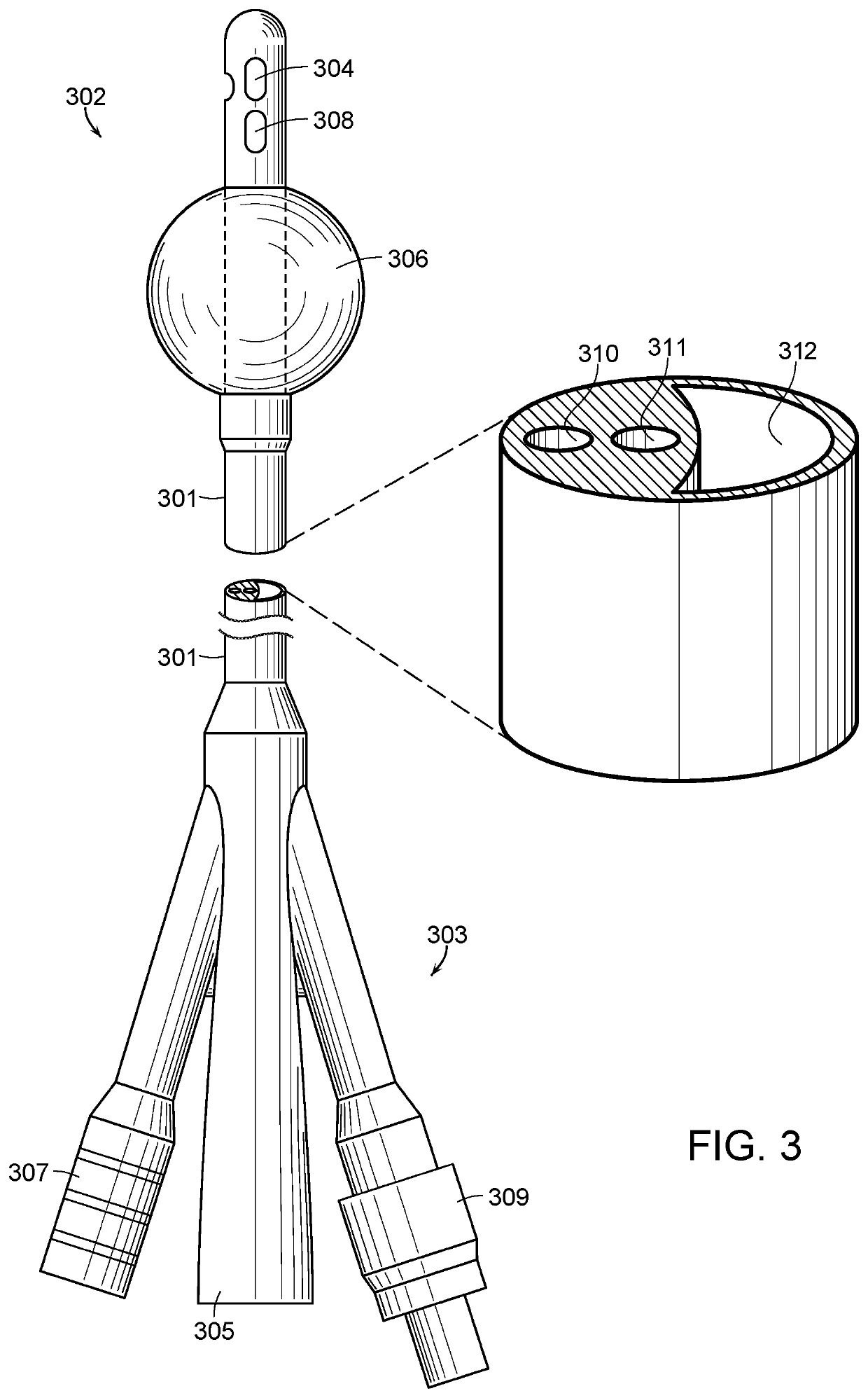 Catheter system for continuous irrigation