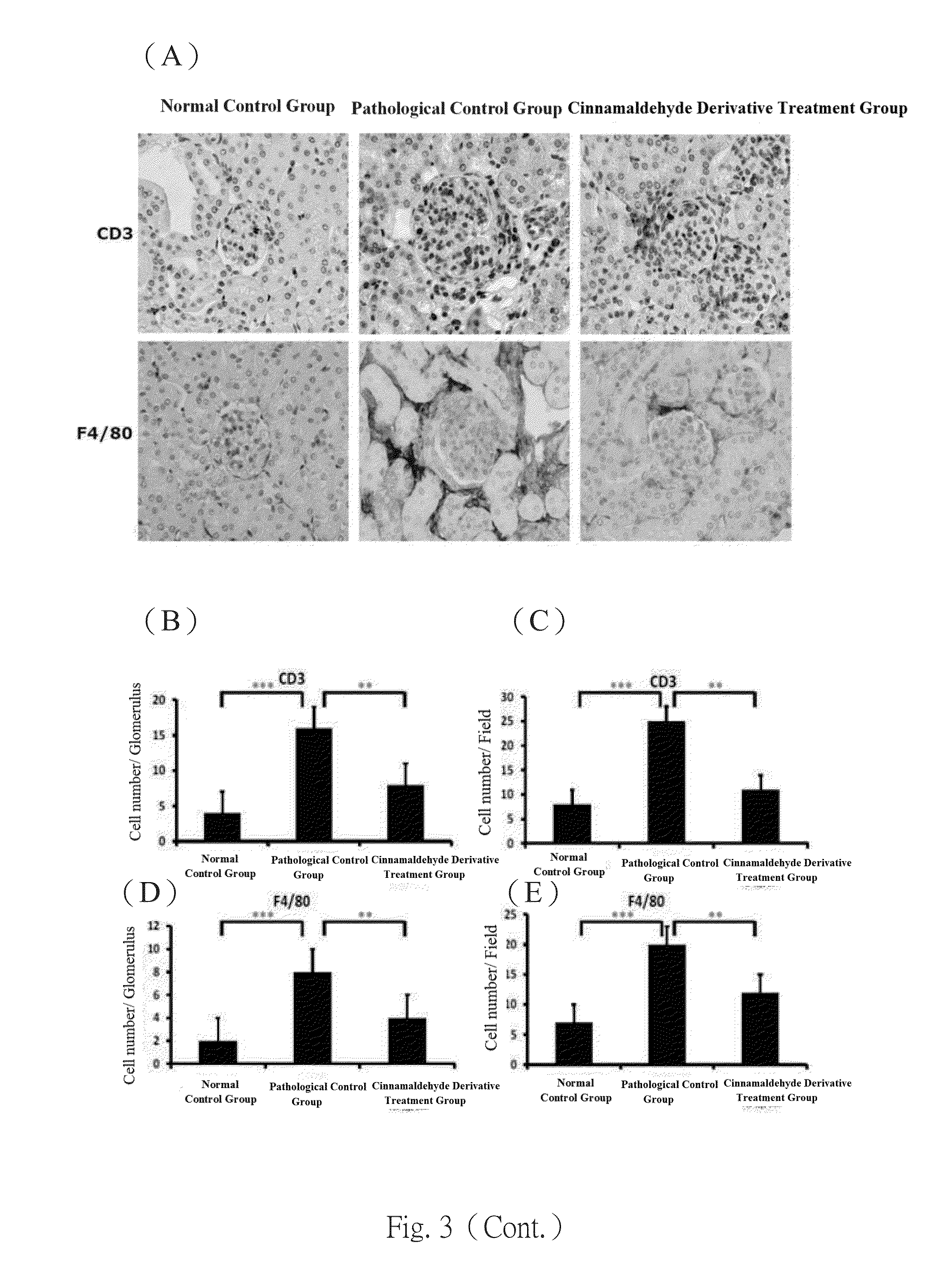 Use of hydroxycinnamaldehyde glycoside derivatives for treating glomerulonephritis