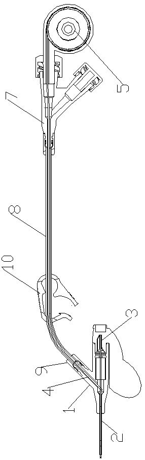 Thrombus preventive indwelling needle not blocking needle tubing