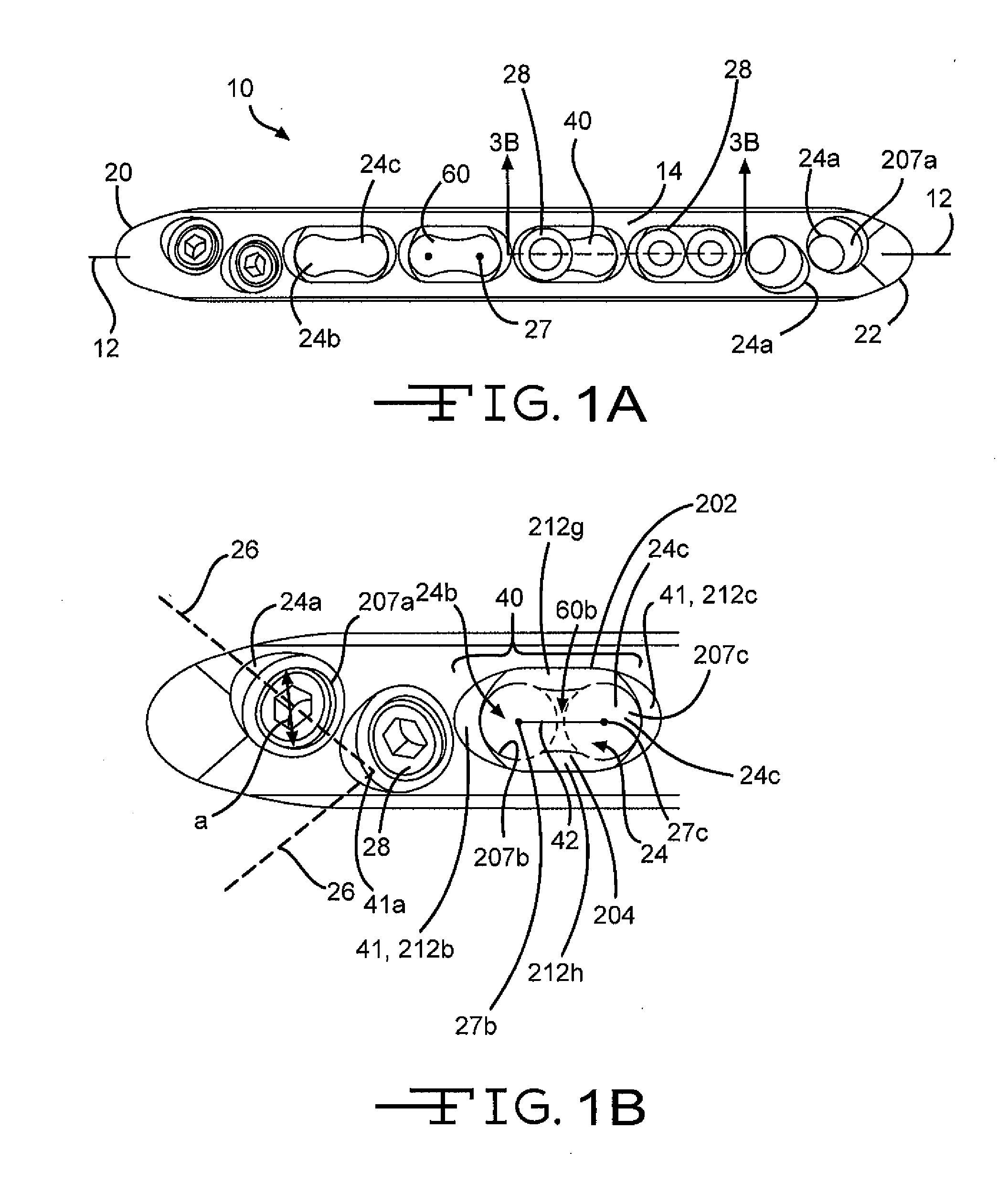 Bone Plate with Complex, Adjacent Holes Joined by a Relief-Space