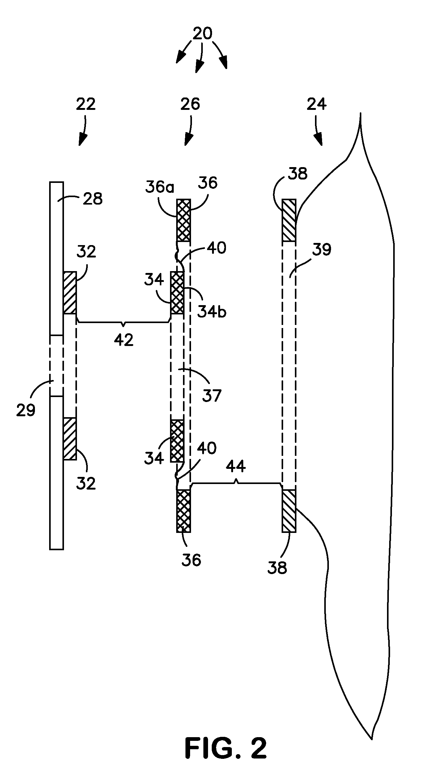 Adaptor for ostomy coupling