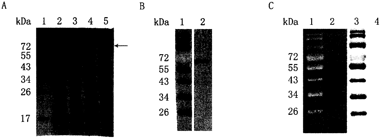 Eimeria tenella AN1-like Zinc finger domain-containing protein and application thereof in inhibiting invasion of coccidium