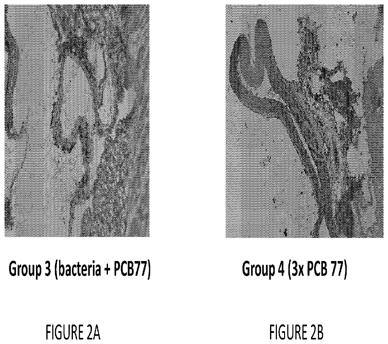 Biomarkers of vascular disease