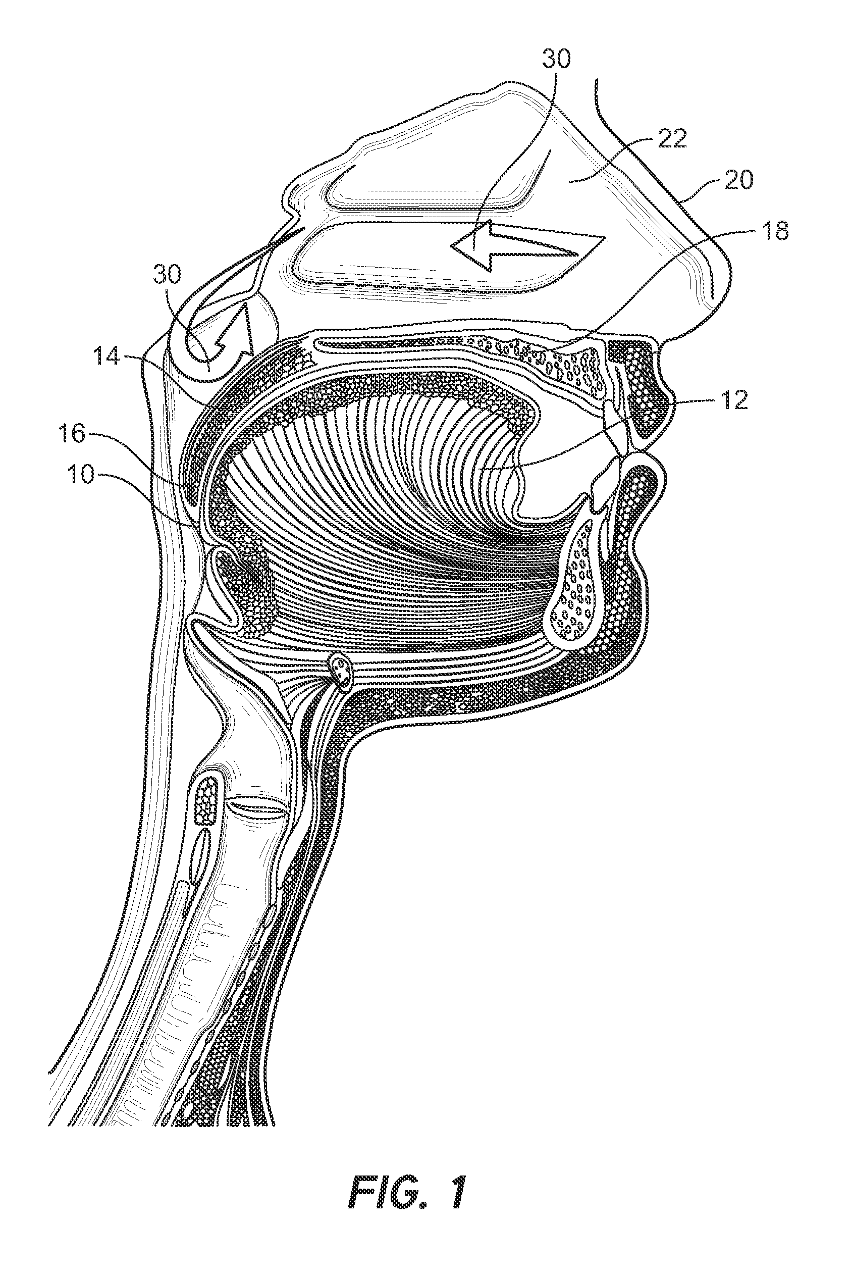 System and method for  delivering a therapy and sensing a biological activity in the mouth