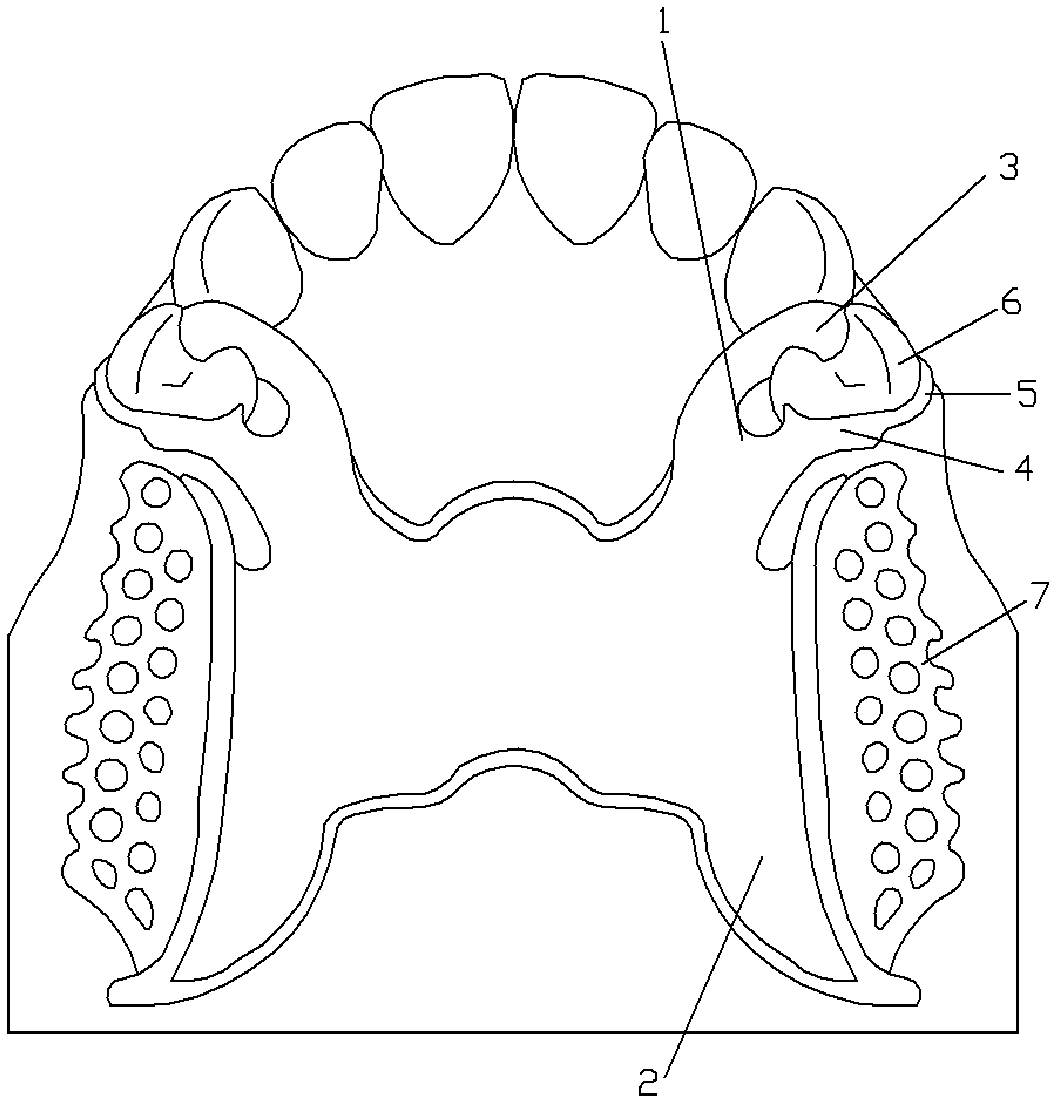 Plate rod snap ring for removable partial denture