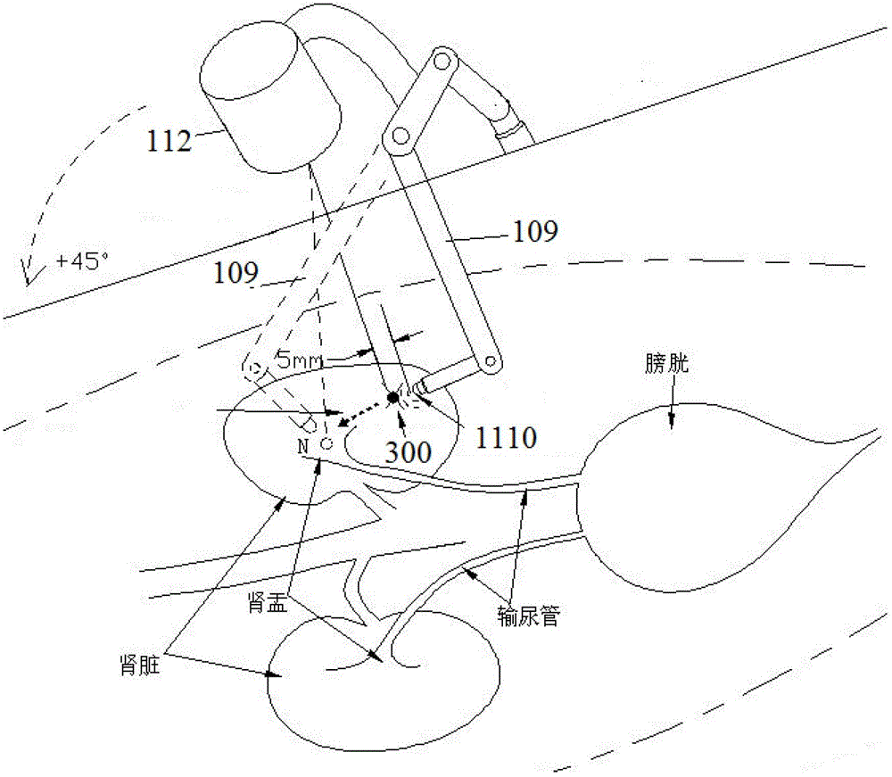 In-vitro calculus removing equipment